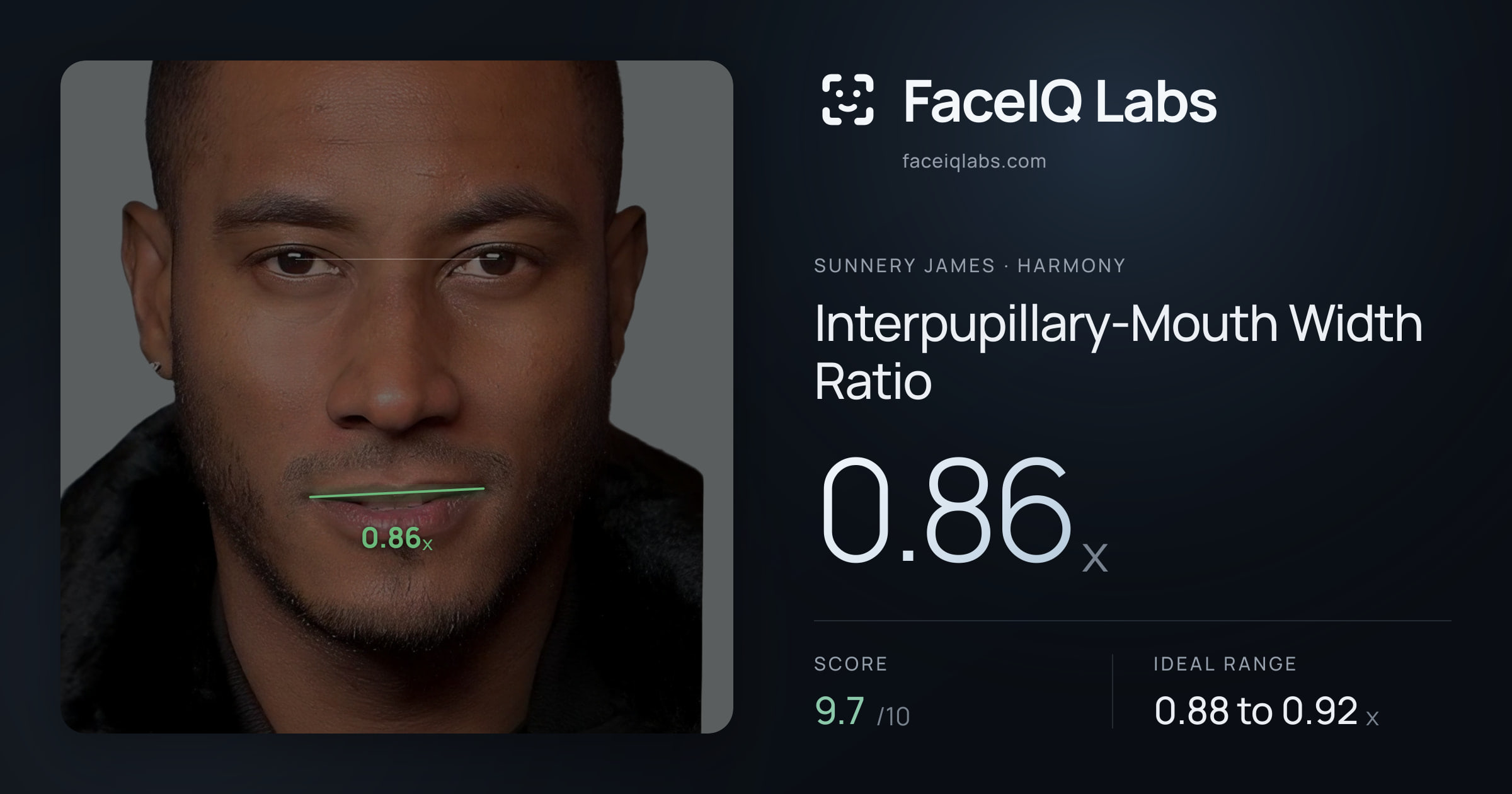 Sunnery James Interpupillary-Mouth Width Ratio: 0.86x, drawn on the photo