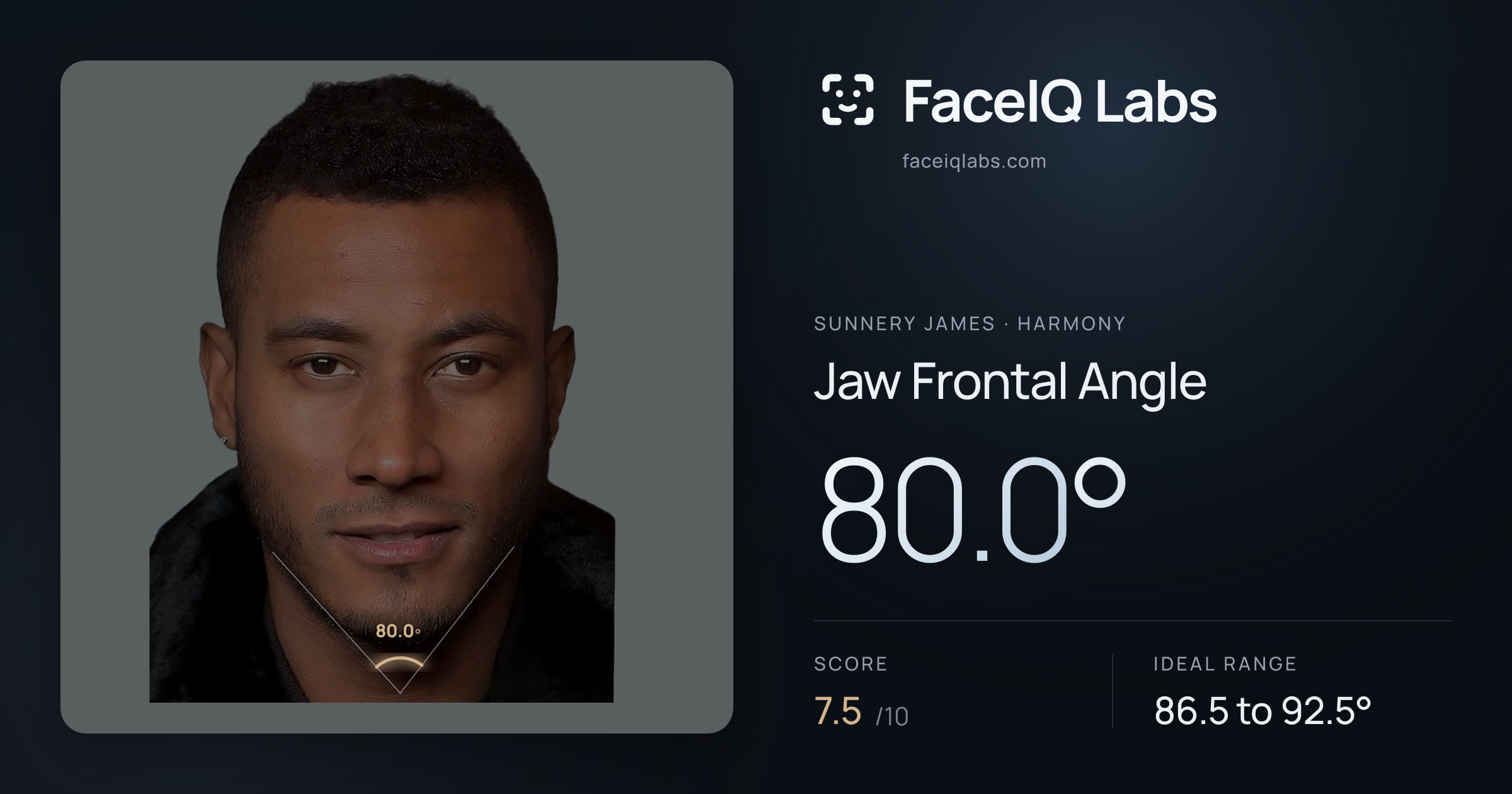 Sunnery James Jaw Frontal Angle: 80.0°, drawn on the photo