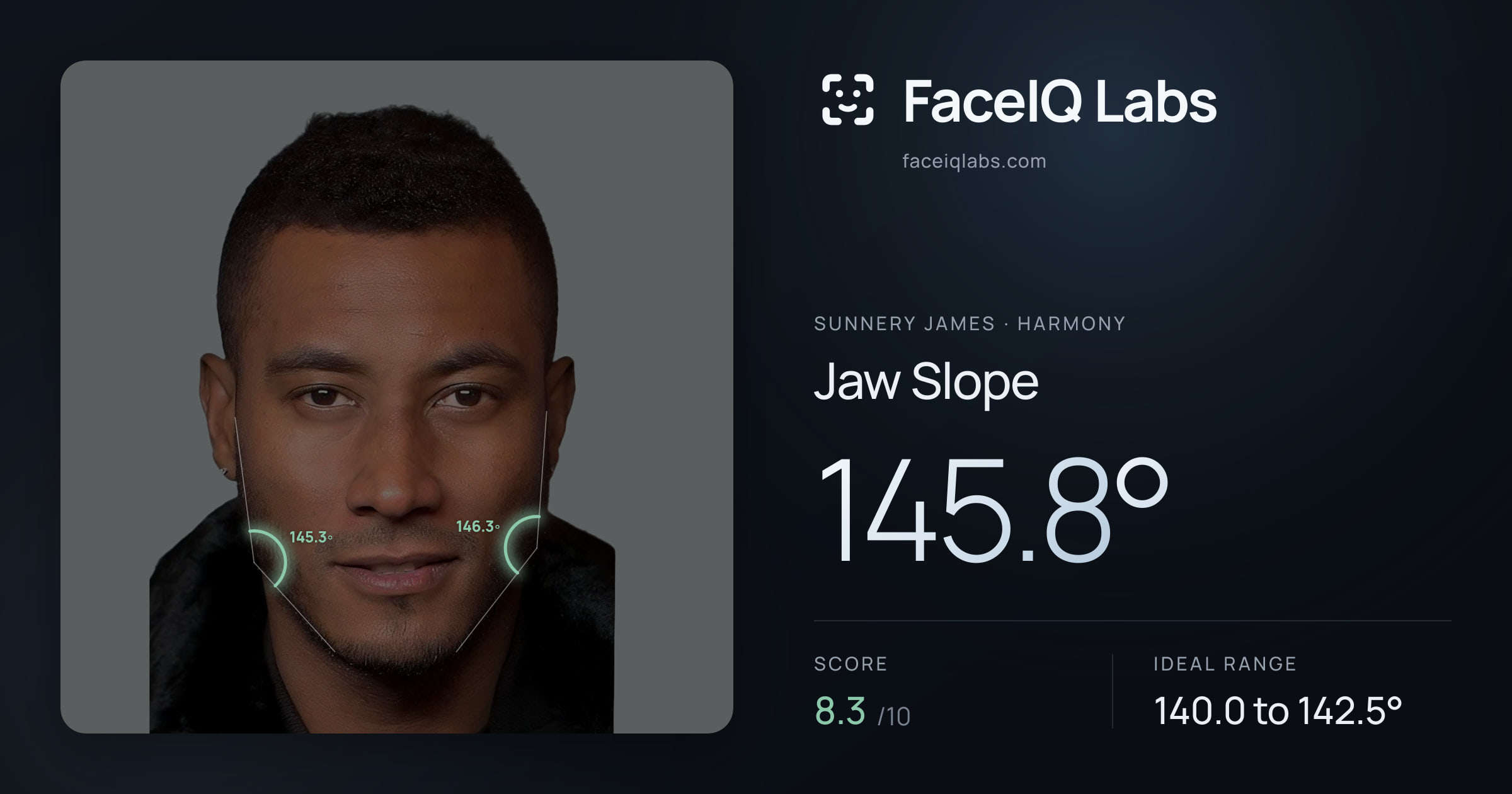 Sunnery James Jaw Slope: 145.8°, drawn on the photo