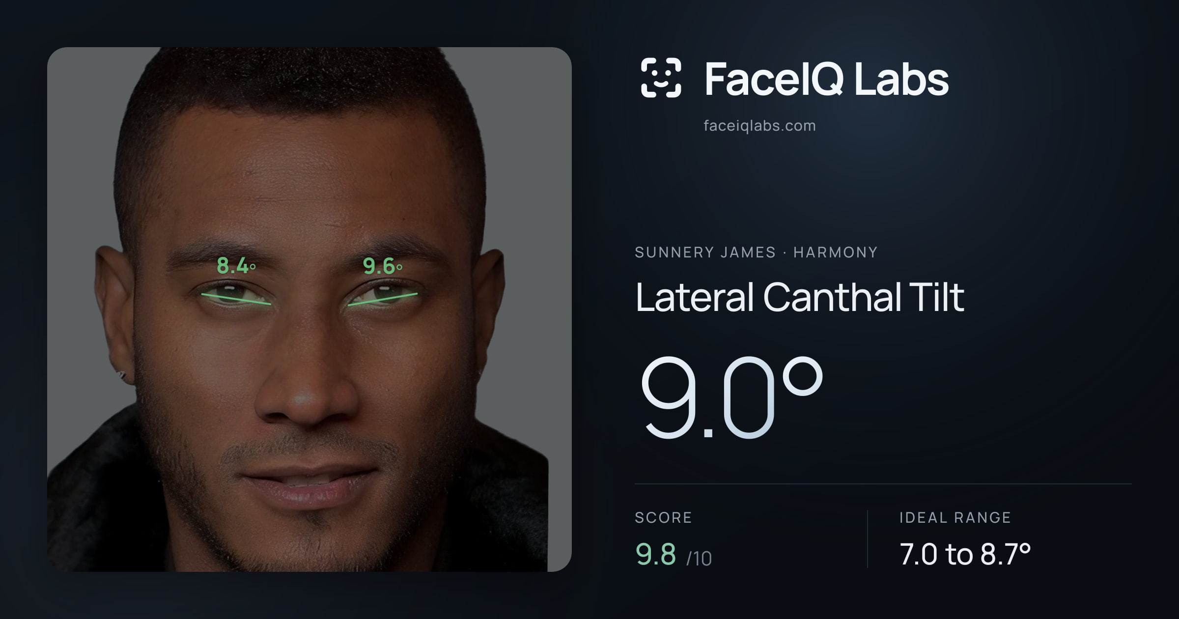 Sunnery James Lateral Canthal Tilt: 9.0°, drawn on the photo