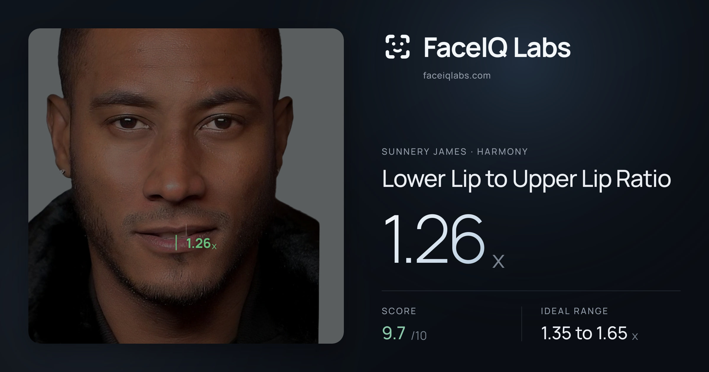 Sunnery James Lower Lip to Upper Lip Ratio: 1.26x, drawn on the photo