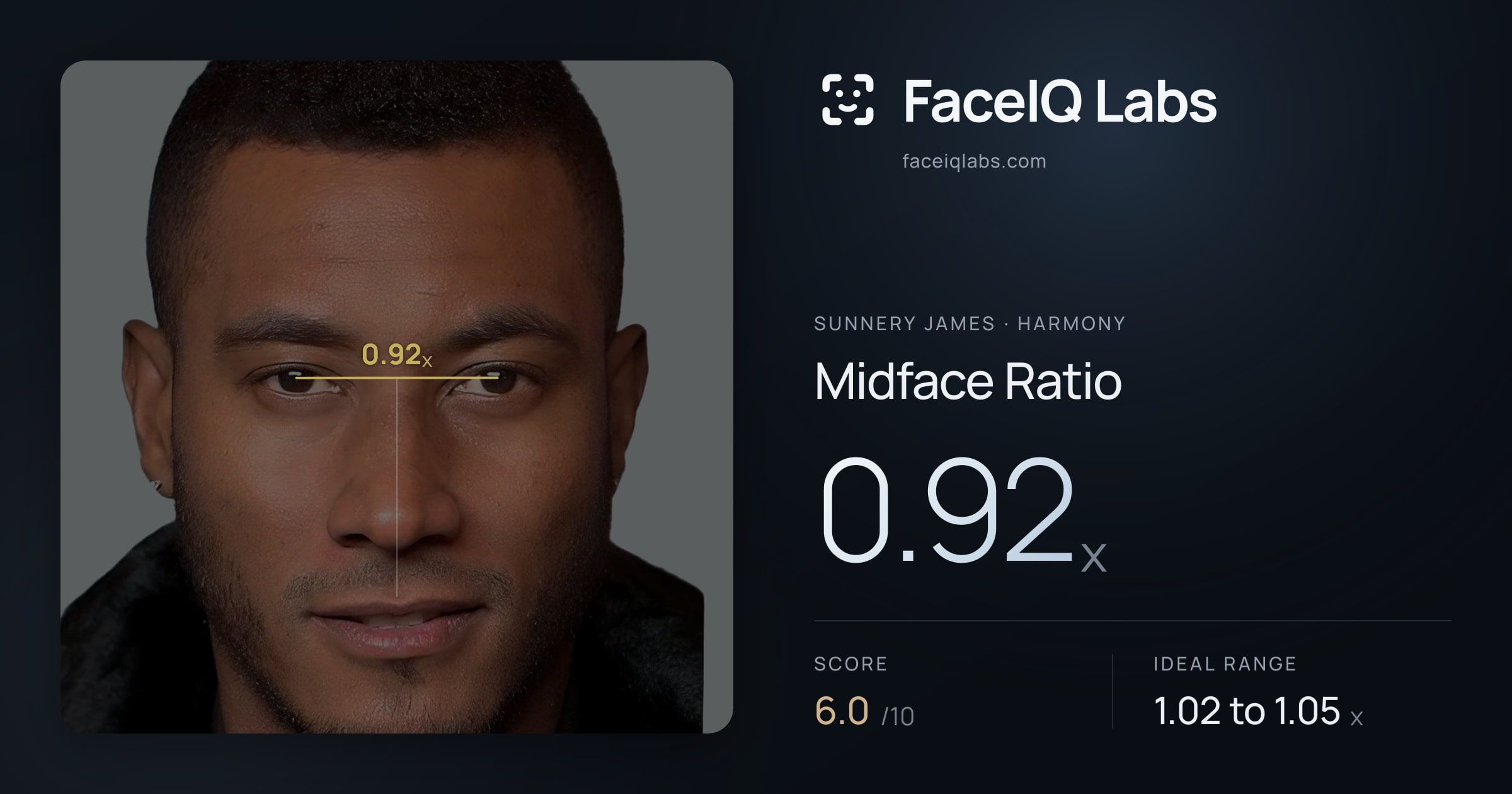 Sunnery James Midface Ratio: 0.92x, drawn on the photo