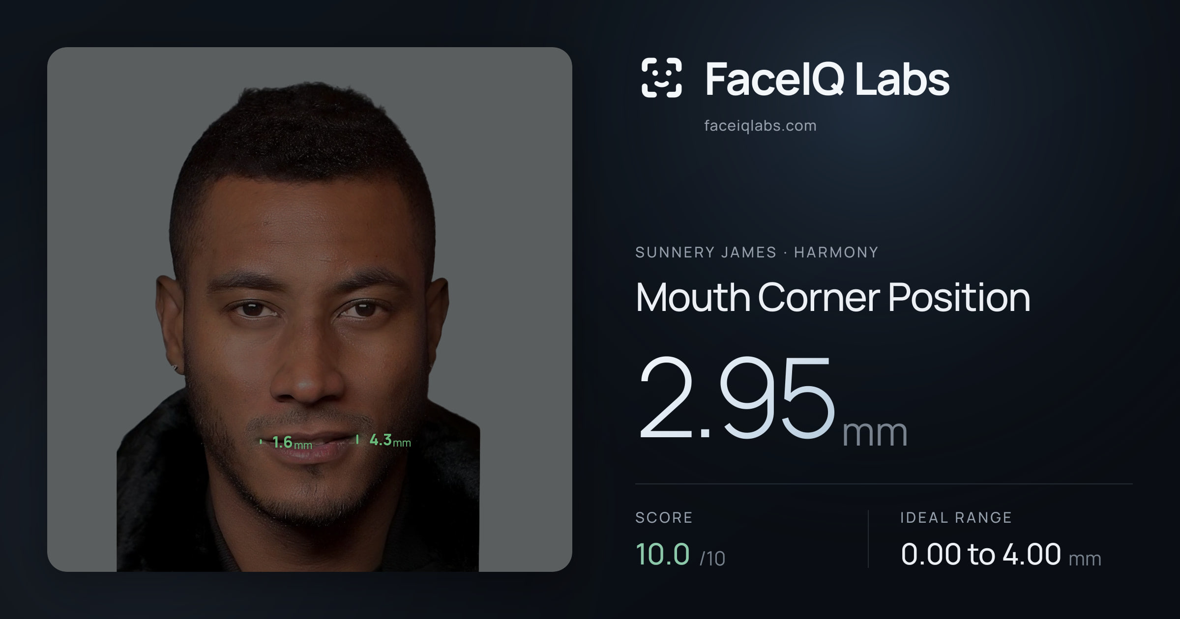 Sunnery James Mouth Corner Position: 2.95mm, drawn on the photo