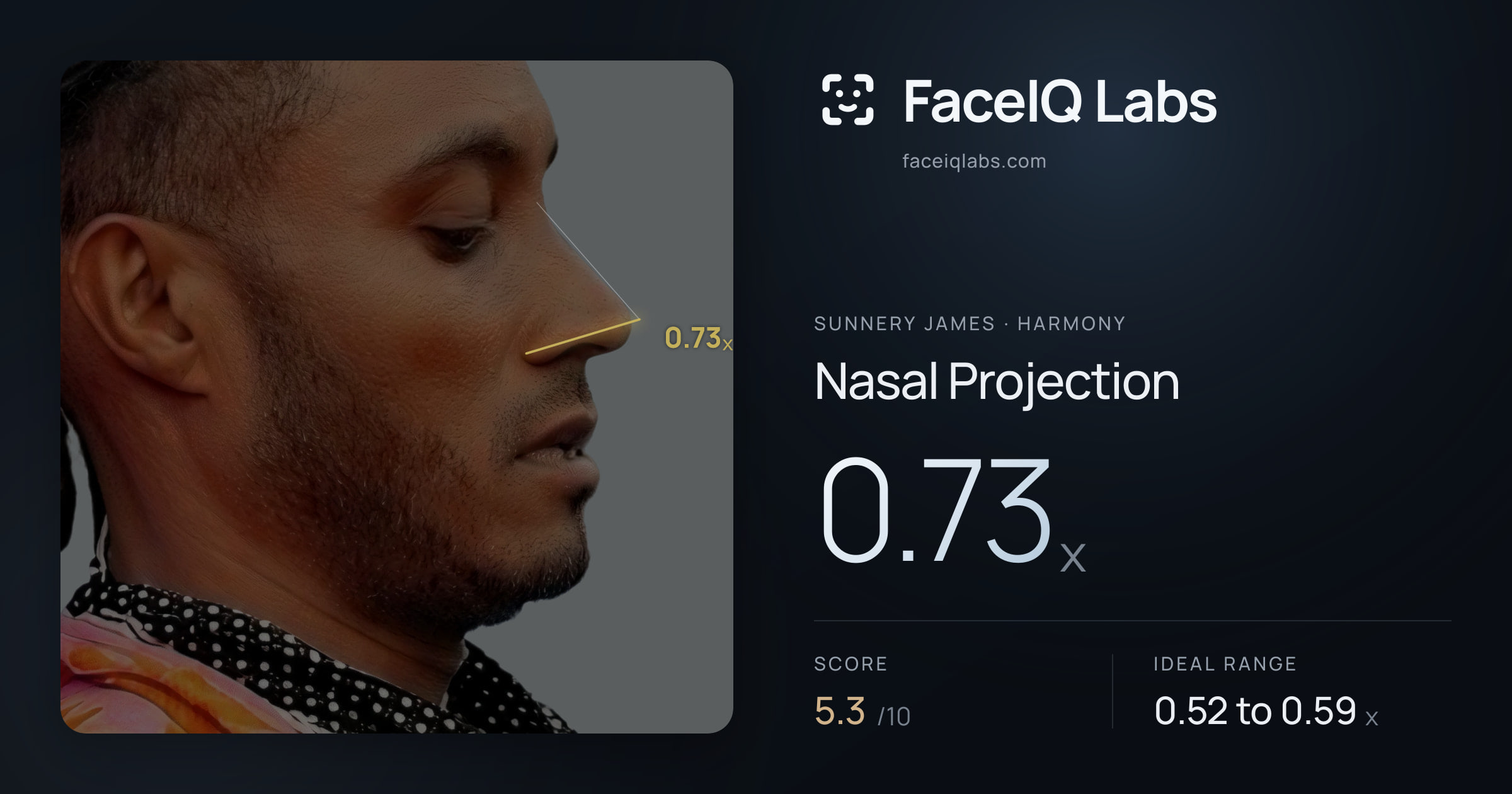 Sunnery James Nasal Projection: 0.73x, drawn on the photo