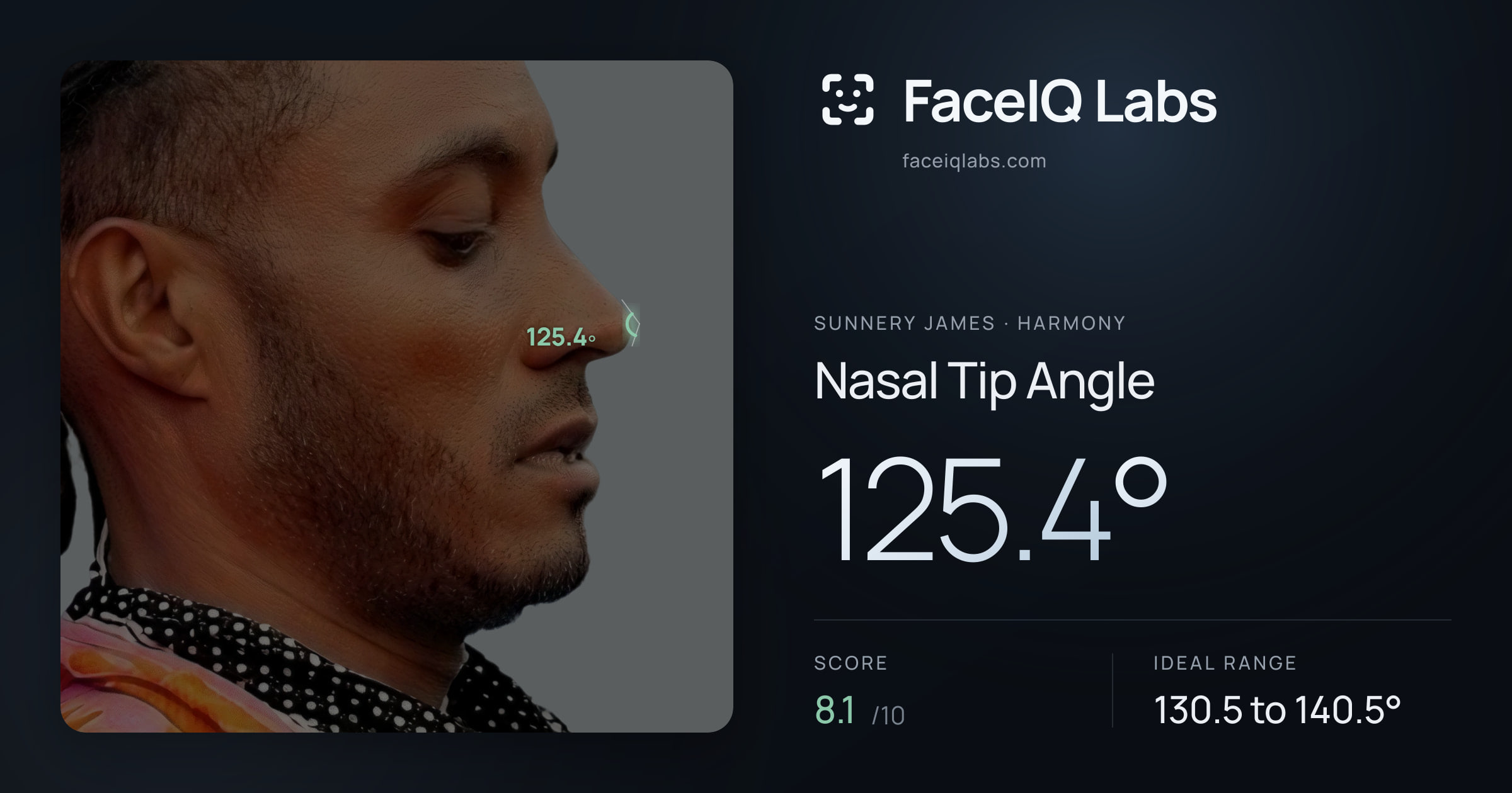Sunnery James Nasal Tip Angle: 125.4°, drawn on the photo