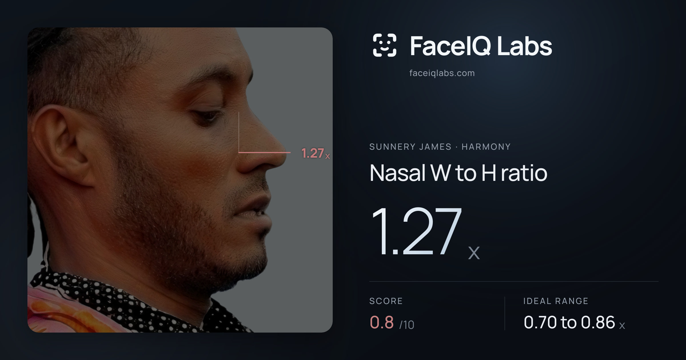 Sunnery James Nasal W to H ratio: 1.27x, drawn on the photo