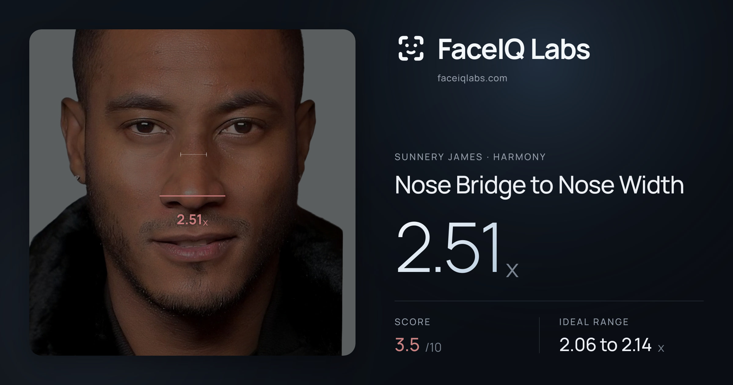 Sunnery James Nose Bridge to Nose Width: 2.51x, drawn on the photo