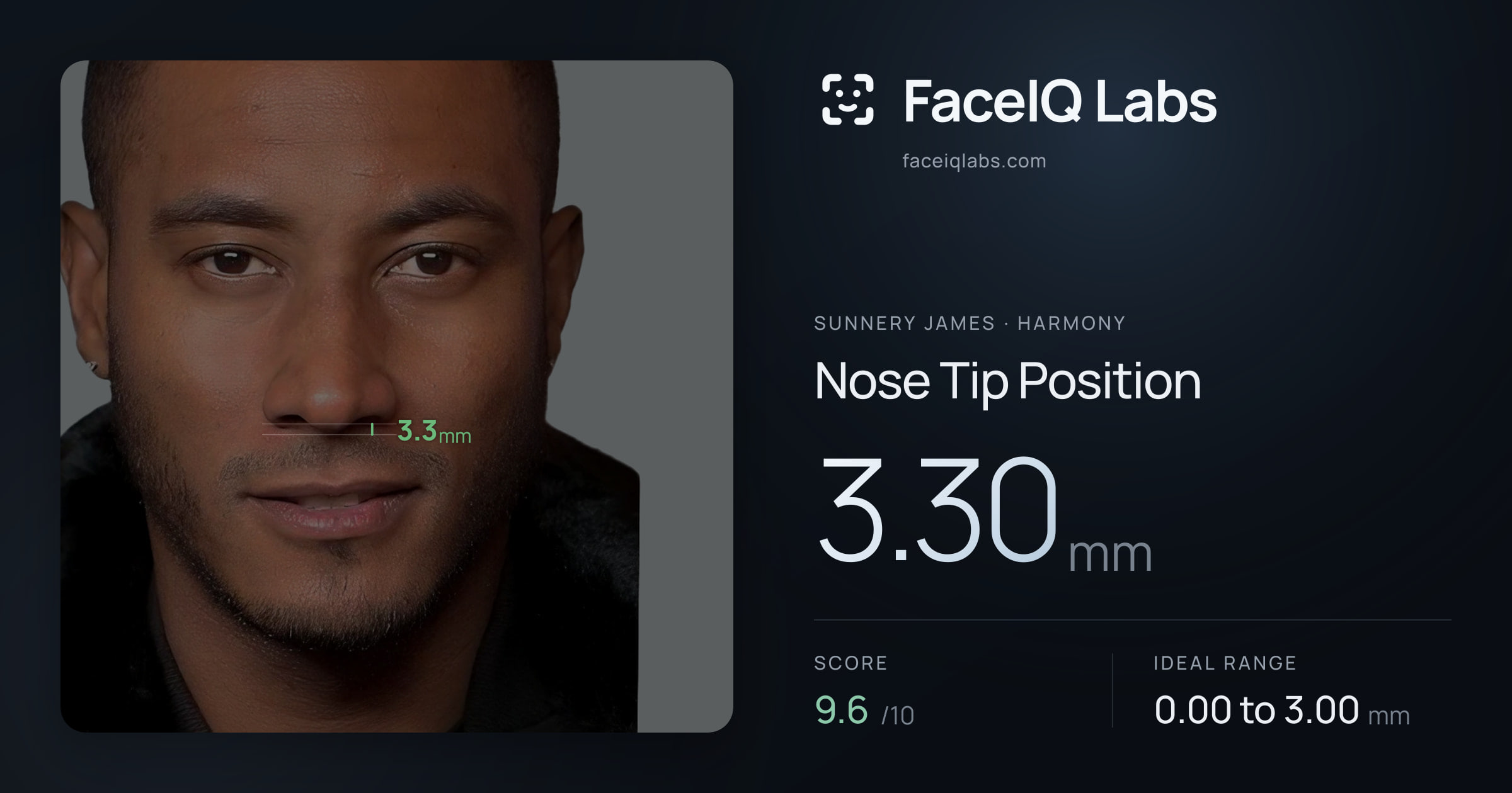 Sunnery James Nose Tip Position: 3.30mm, drawn on the photo
