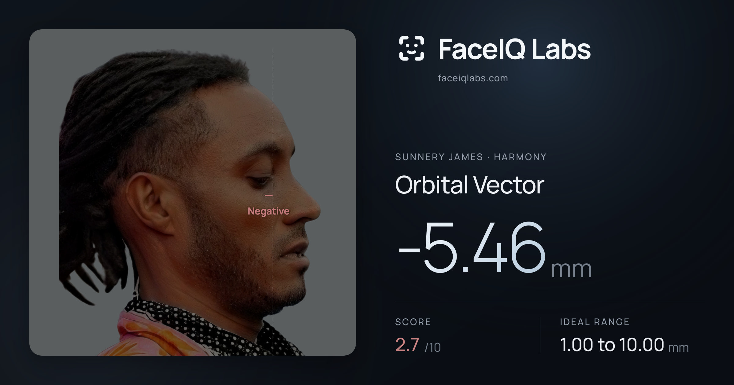 Sunnery James Orbital Vector: -5.46mm, drawn on the photo