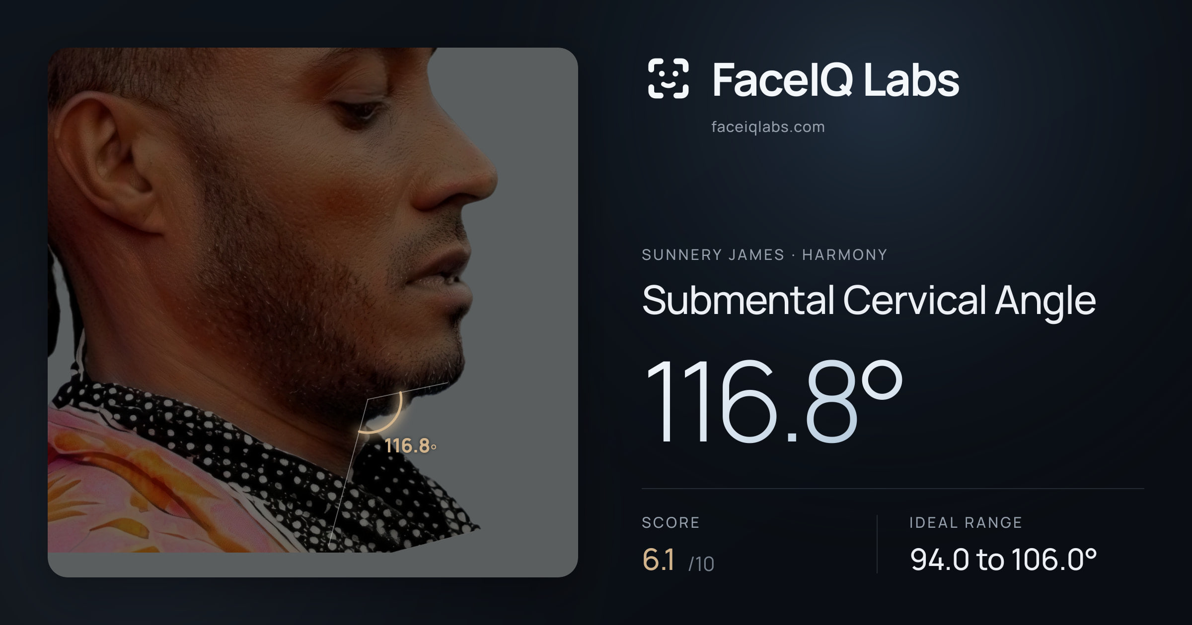 Sunnery James Submental Cervical Angle: 116.8°, drawn on the photo