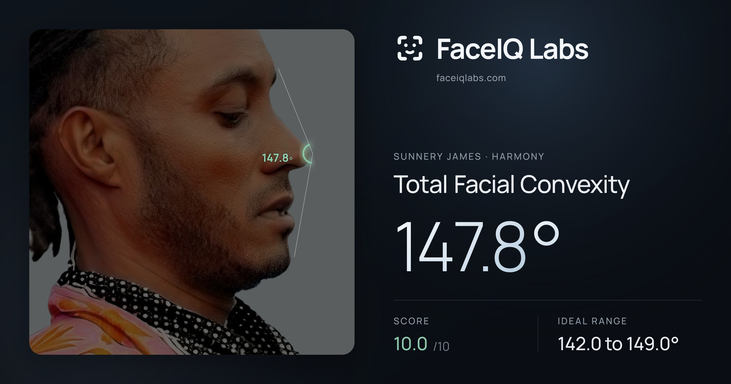 Sunnery James Total Facial Convexity: 147.8°, drawn on the photo