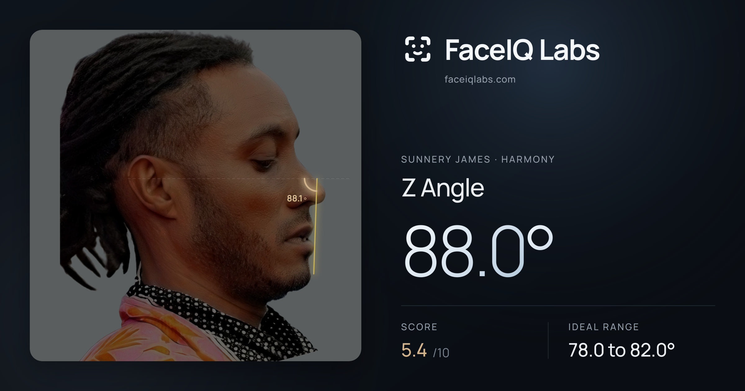 Sunnery James Z Angle: 88.0°, drawn on the photo