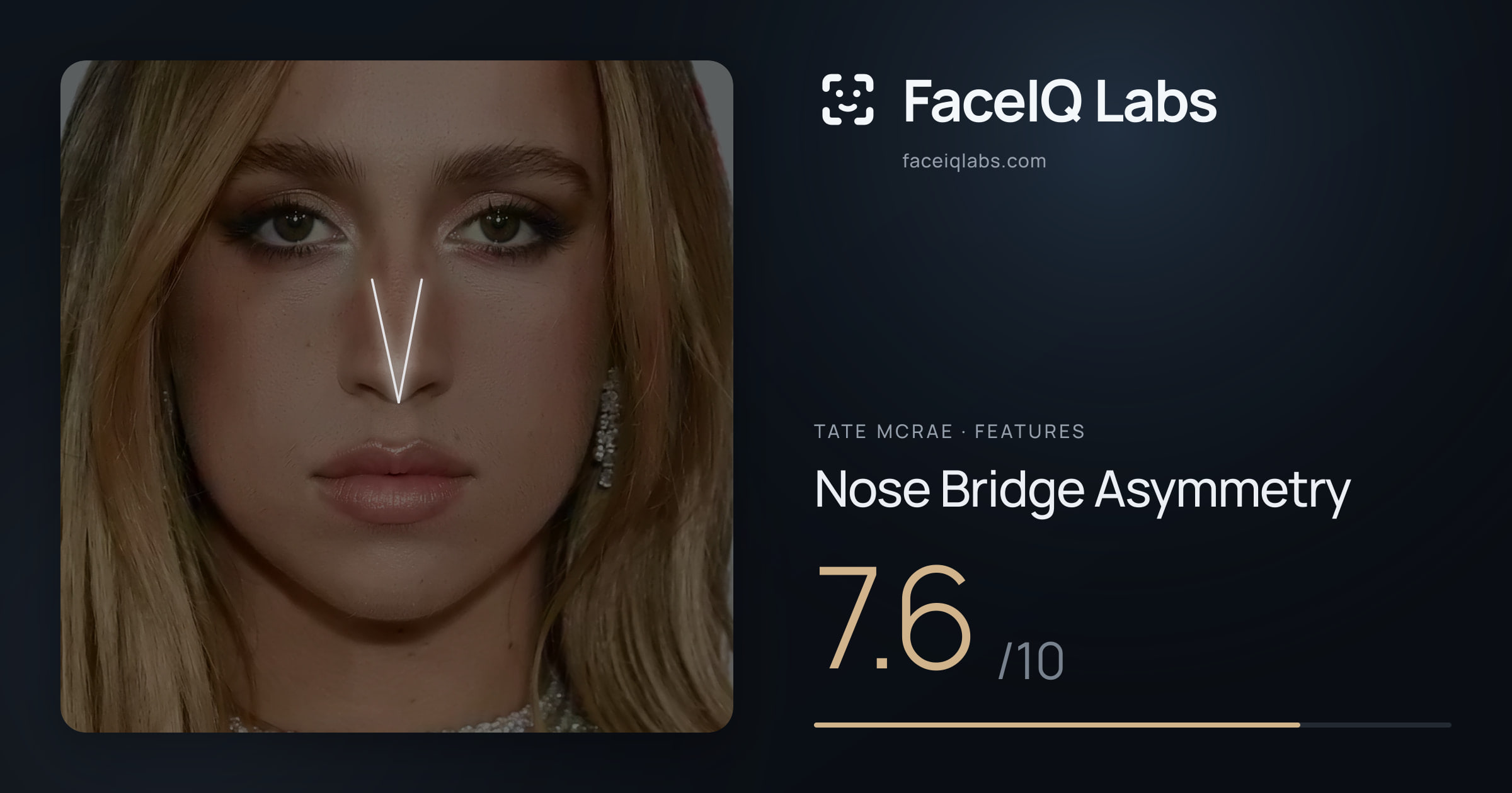 Tate Mcrae Nose Bridge Asymmetry: 7.6/10, drawn on the photo