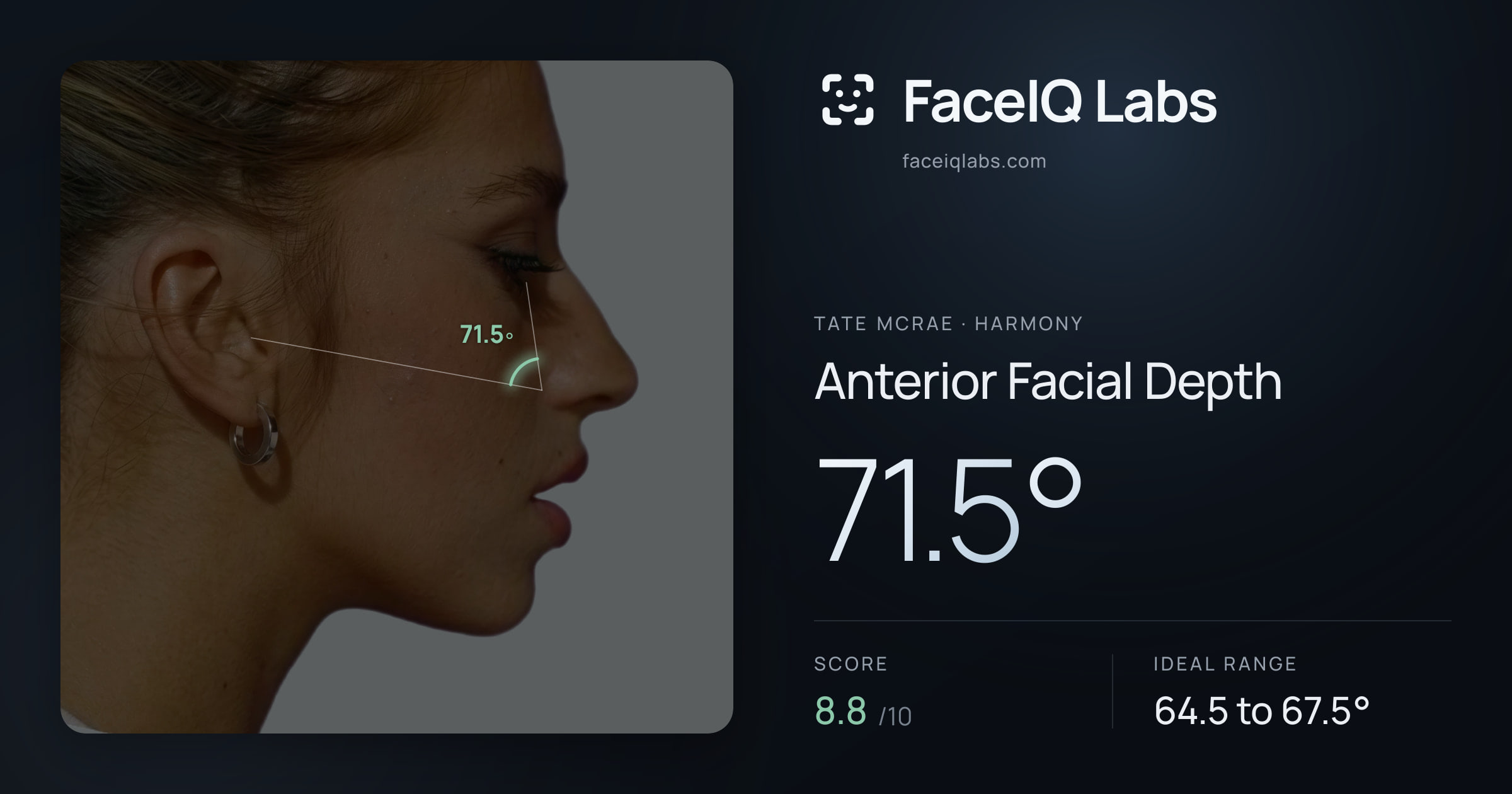 Tate Mcrae Anterior Facial Depth: 71.5°, drawn on the photo