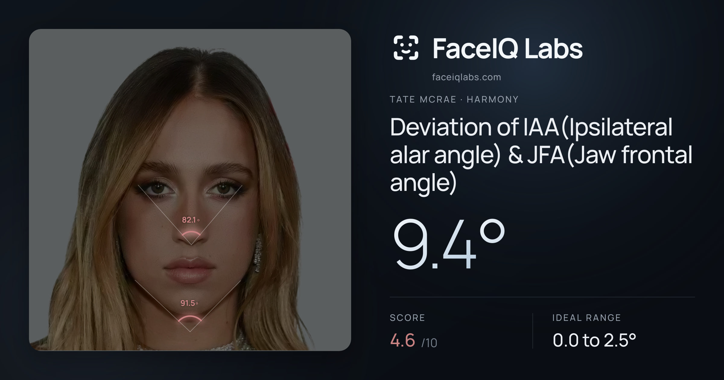 Tate Mcrae Deviation of IAA(Ipsilateral alar angle) & JFA(Jaw frontal angle): 9.4°, drawn on the photo