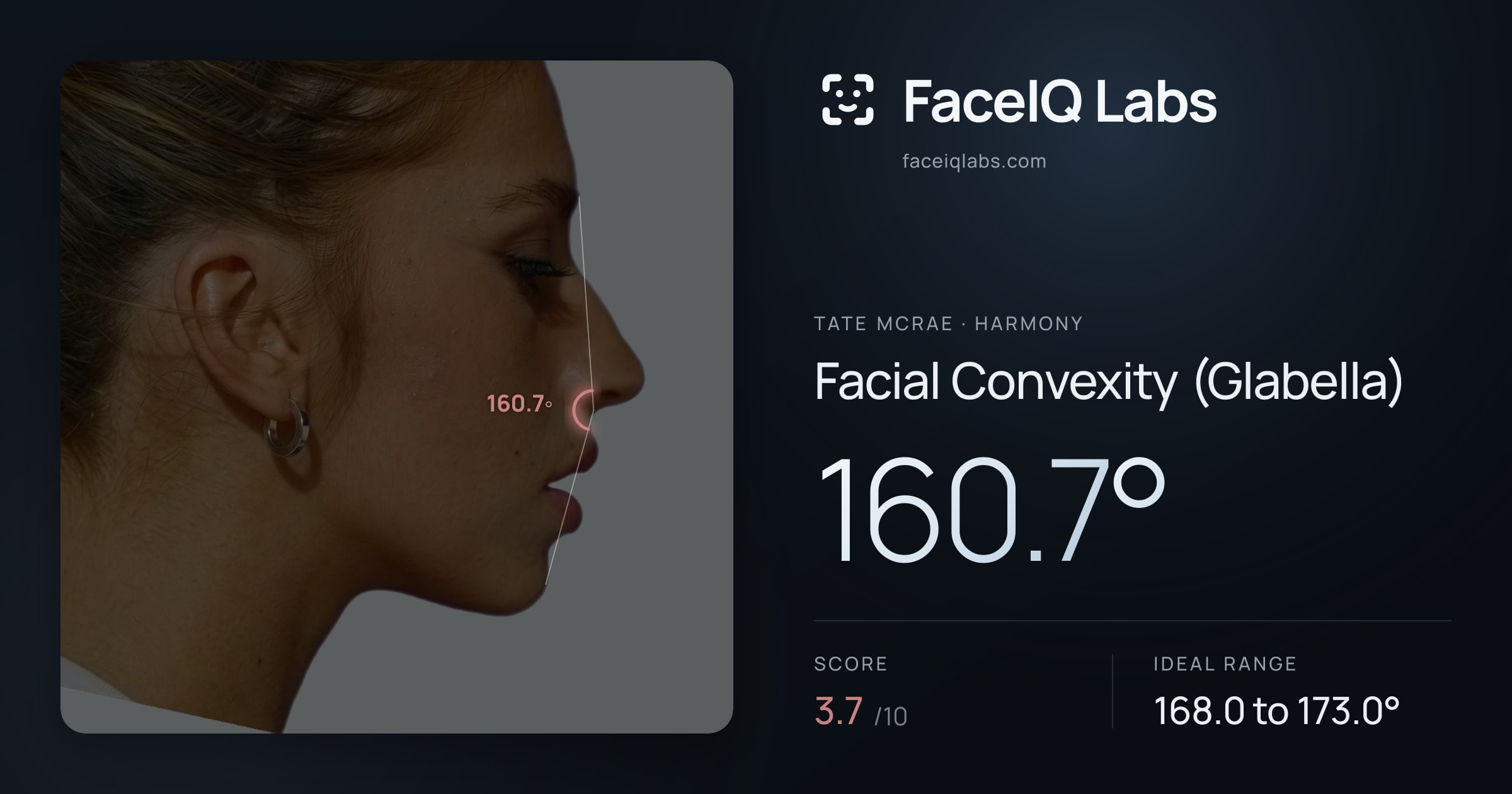 Tate Mcrae Facial Convexity (Glabella): 160.7°, drawn on the photo