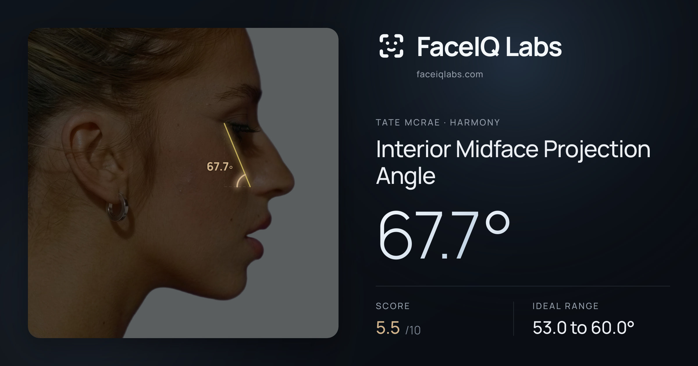Tate Mcrae Interior Midface Projection Angle: 67.7°, drawn on the photo