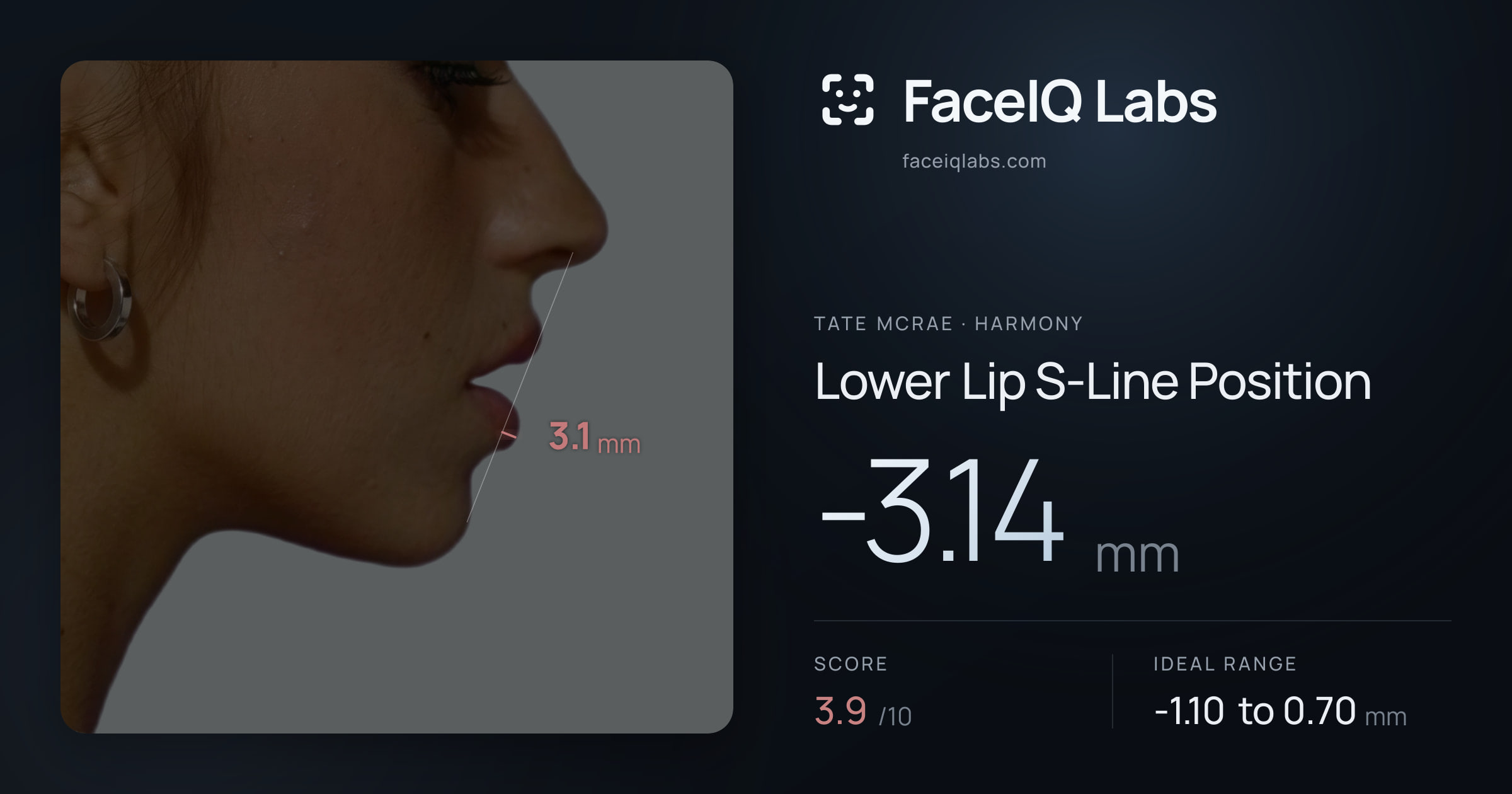 Tate Mcrae Lower Lip S-Line Position: -3.14mm, drawn on the photo