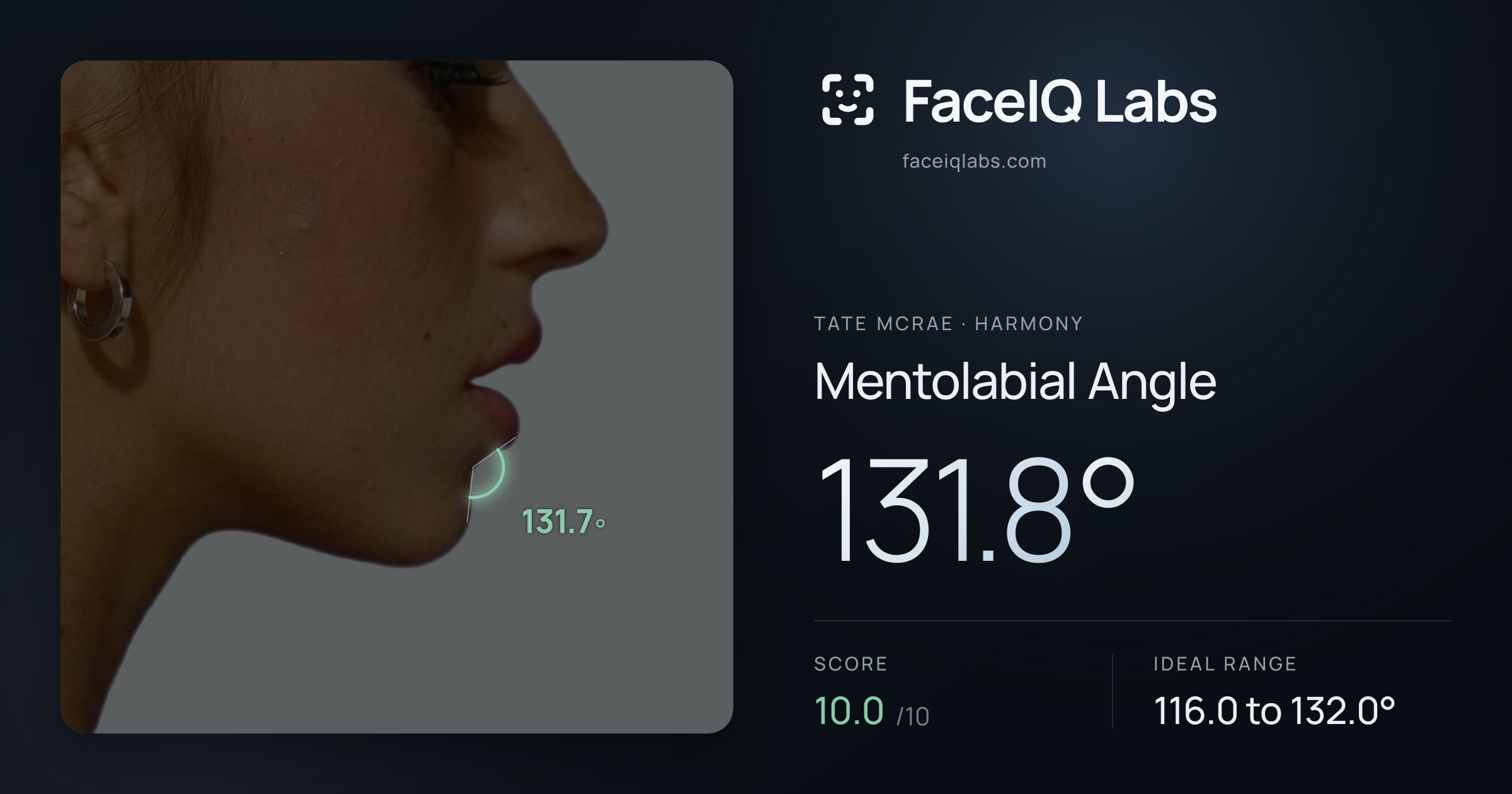 Tate Mcrae Mentolabial Angle: 131.8°, drawn on the photo
