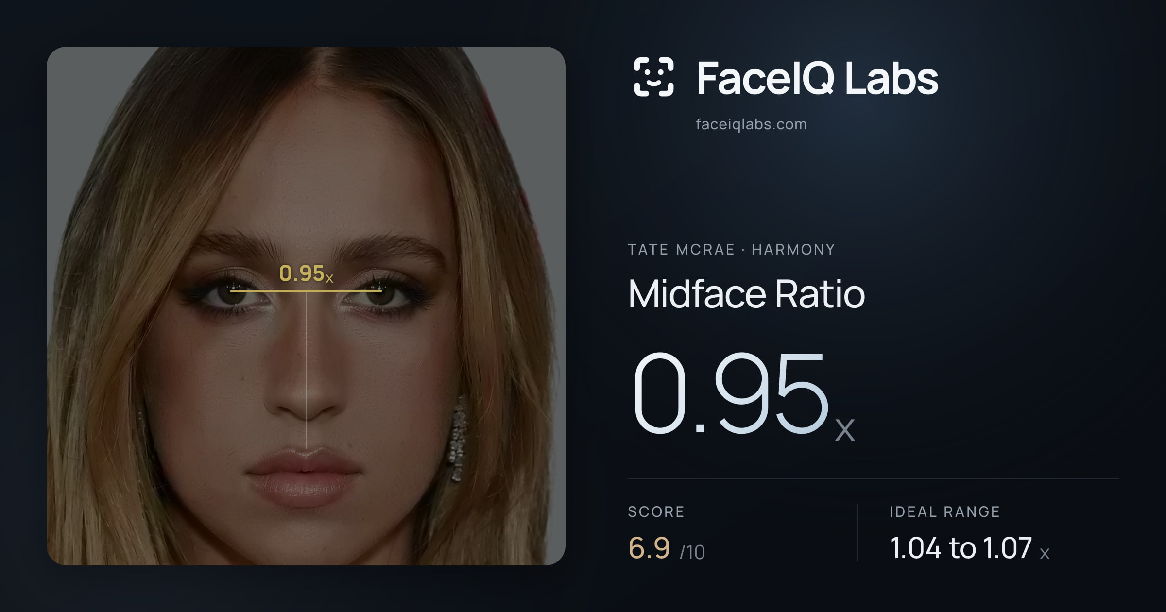 Tate Mcrae Midface Ratio: 0.95x, drawn on the photo