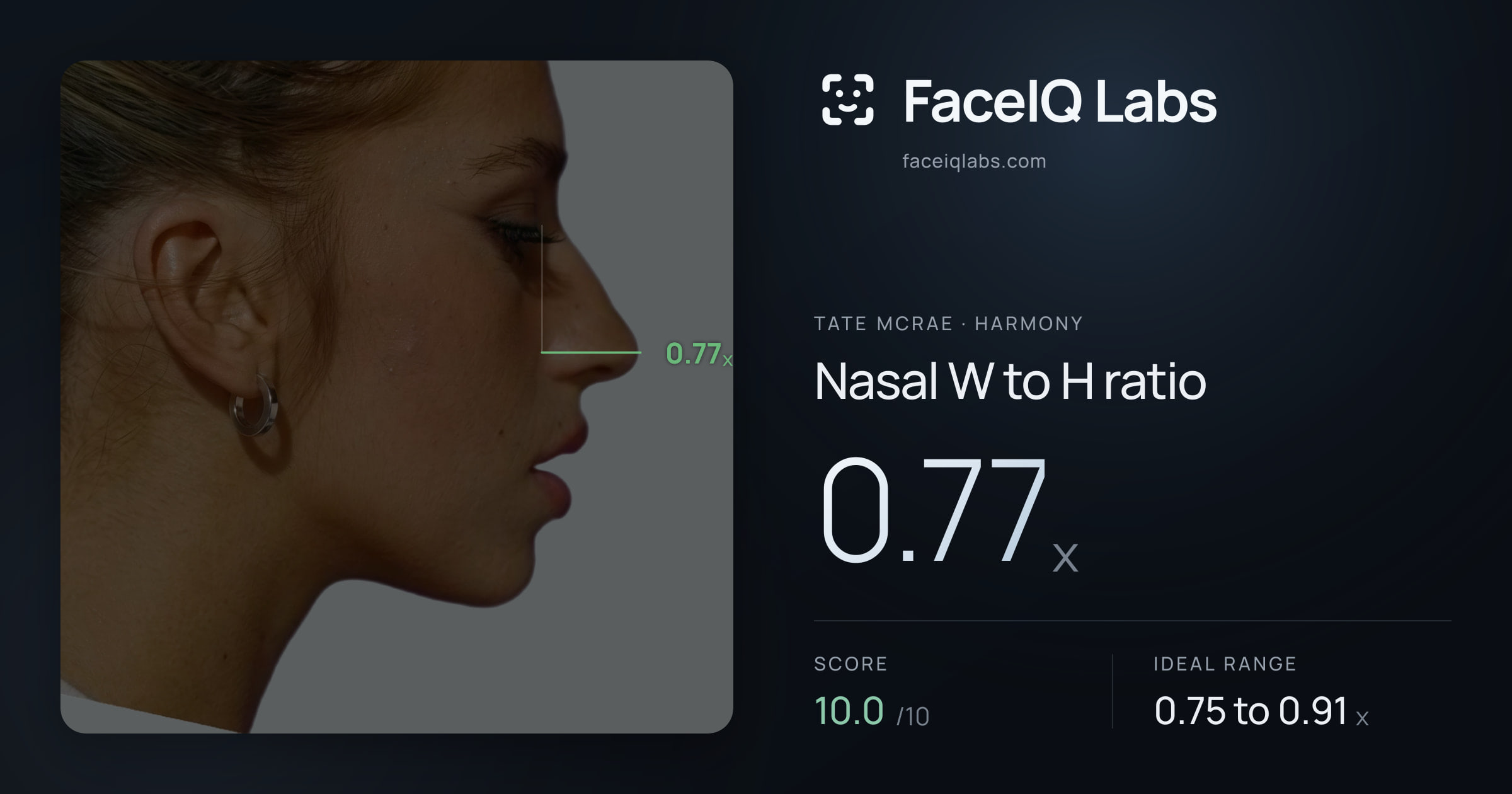 Tate Mcrae Nasal W to H ratio: 0.77x, drawn on the photo