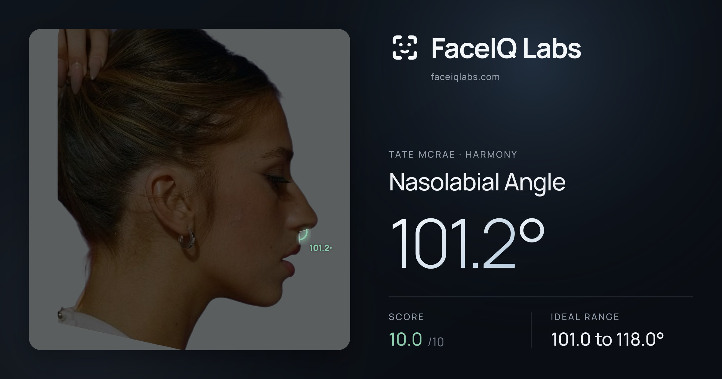 Tate Mcrae Nasolabial Angle: 101.2°, drawn on the photo