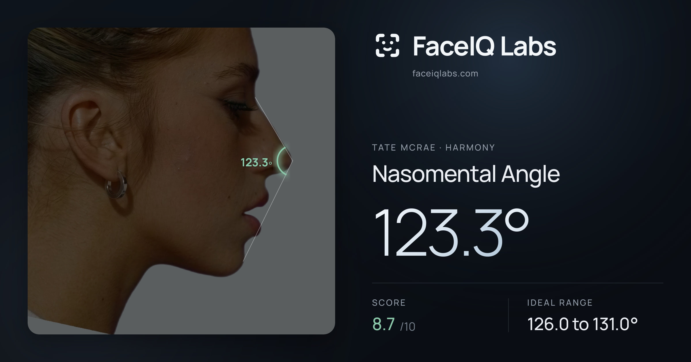 Tate Mcrae Nasomental Angle: 123.3°, drawn on the photo