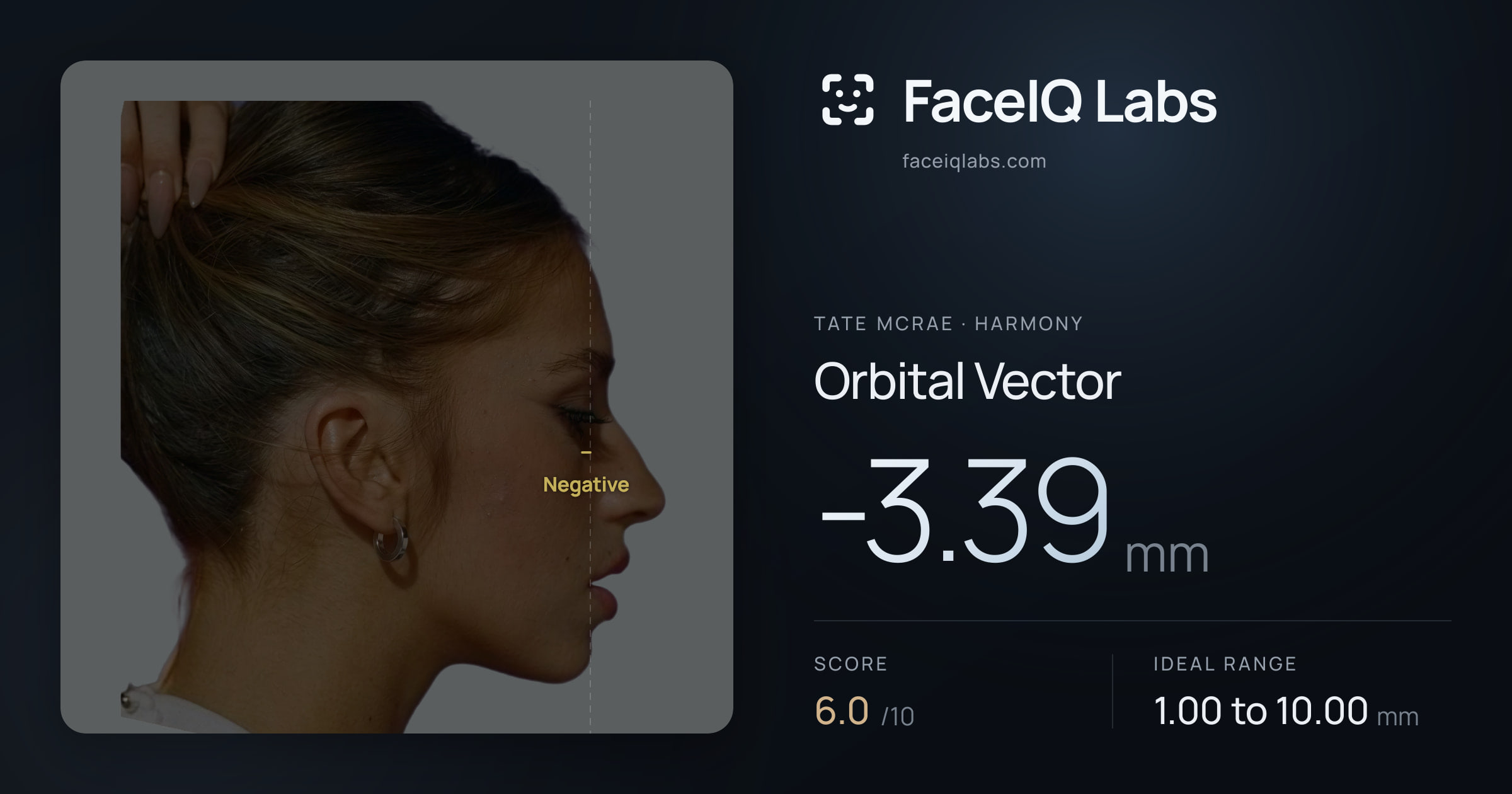 Tate Mcrae Orbital Vector: -3.39mm, drawn on the photo