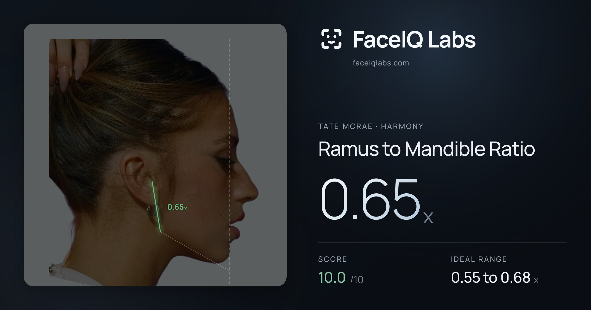 Tate Mcrae Ramus to Mandible Ratio: 0.65x, drawn on the photo