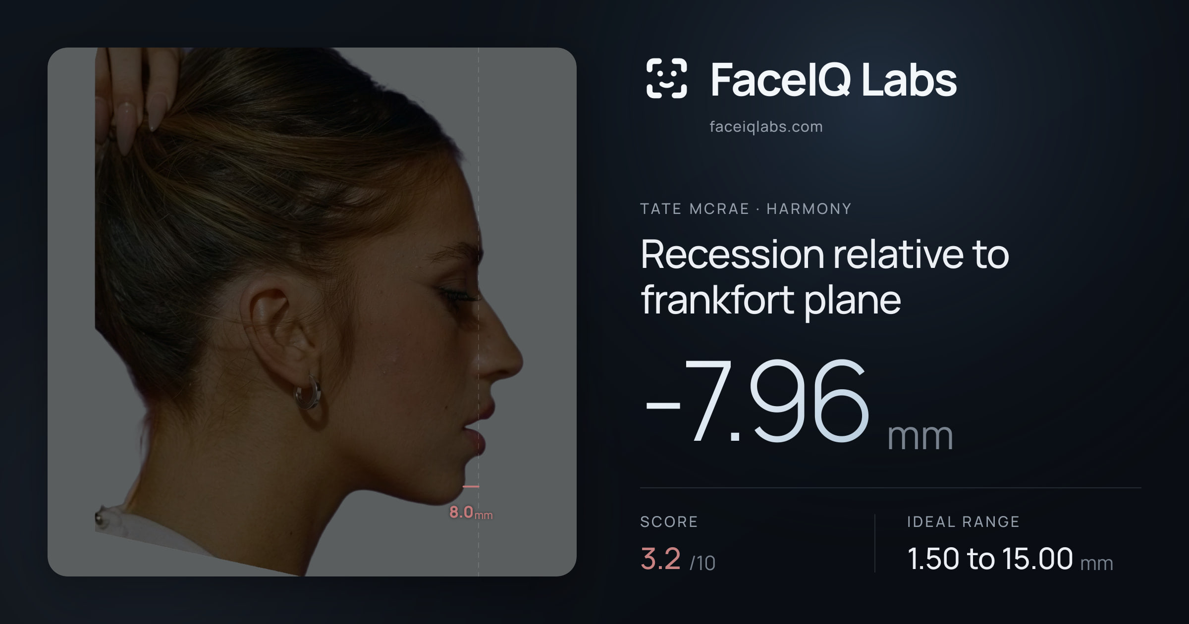Tate Mcrae Recession relative to frankfort plane: -7.96mm, drawn on the photo
