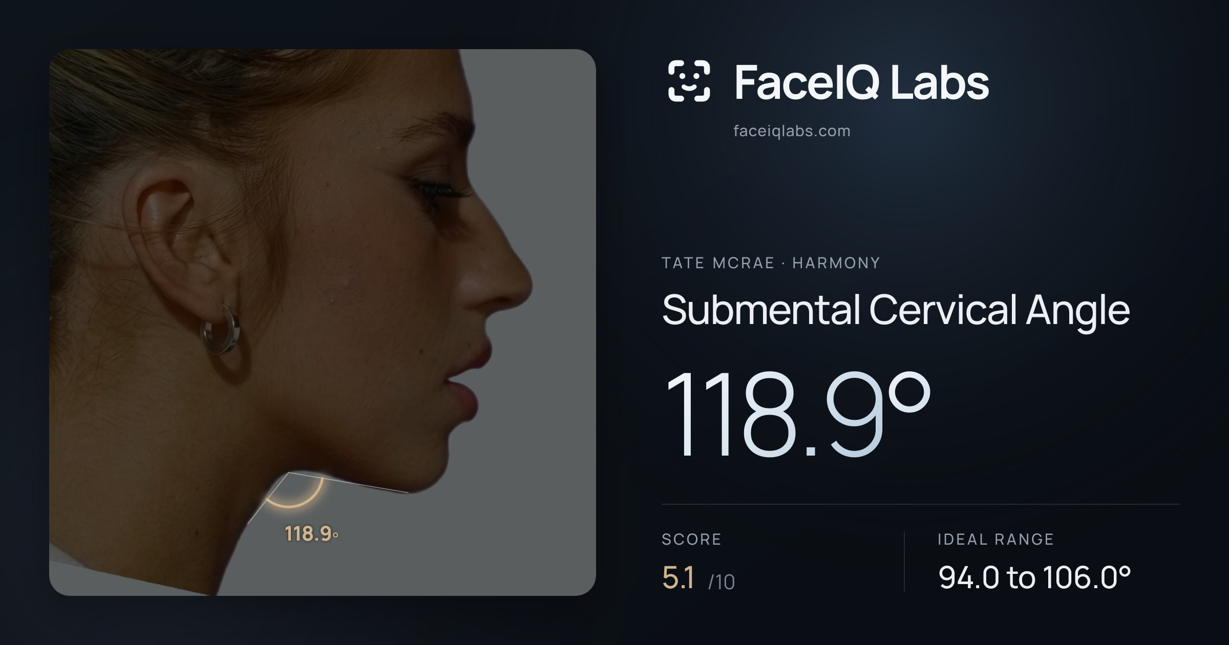 Tate Mcrae Submental Cervical Angle: 118.9°, drawn on the photo