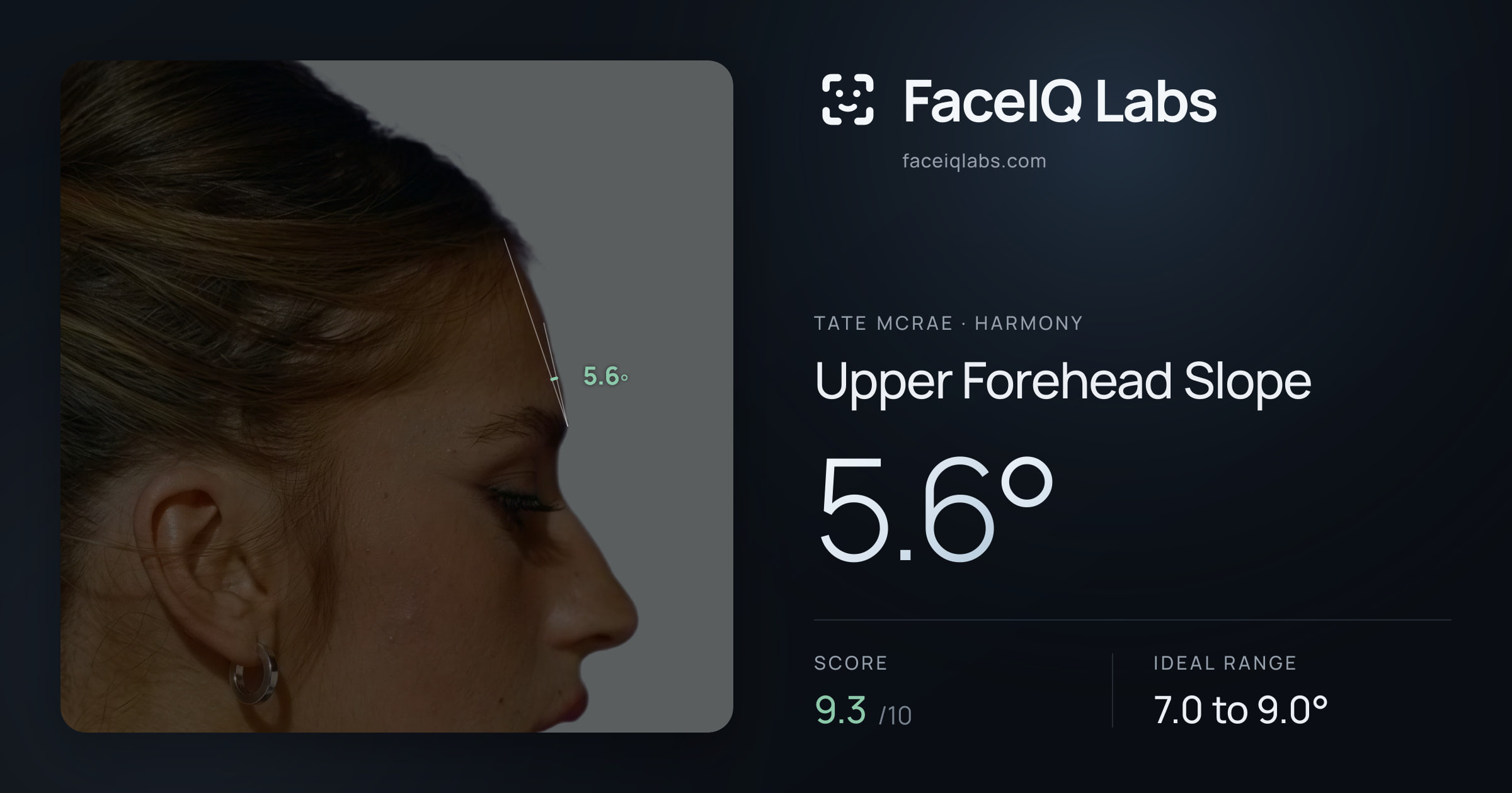 Tate Mcrae Upper Forehead Slope: 5.6°, drawn on the photo