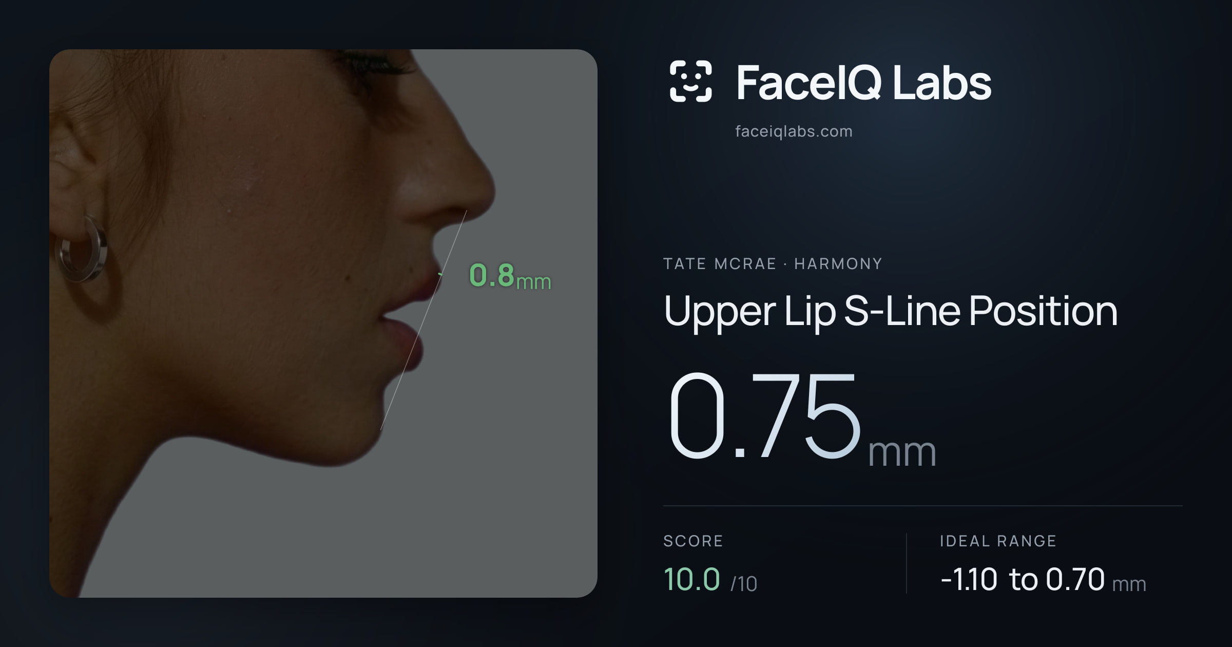 Tate Mcrae Upper Lip S-Line Position: 0.75mm, drawn on the photo