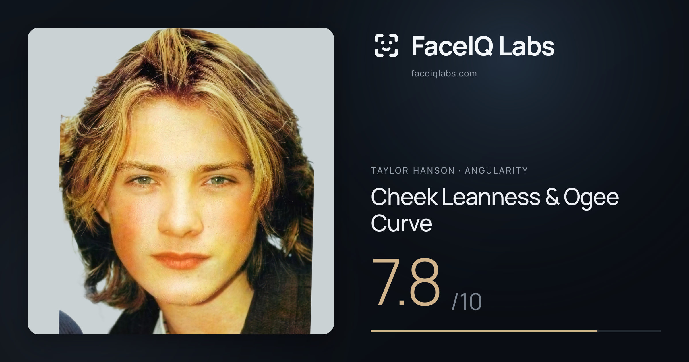 Taylor Hanson Cheek Leanness & Ogee Curve: 7.8/10, drawn on the photo