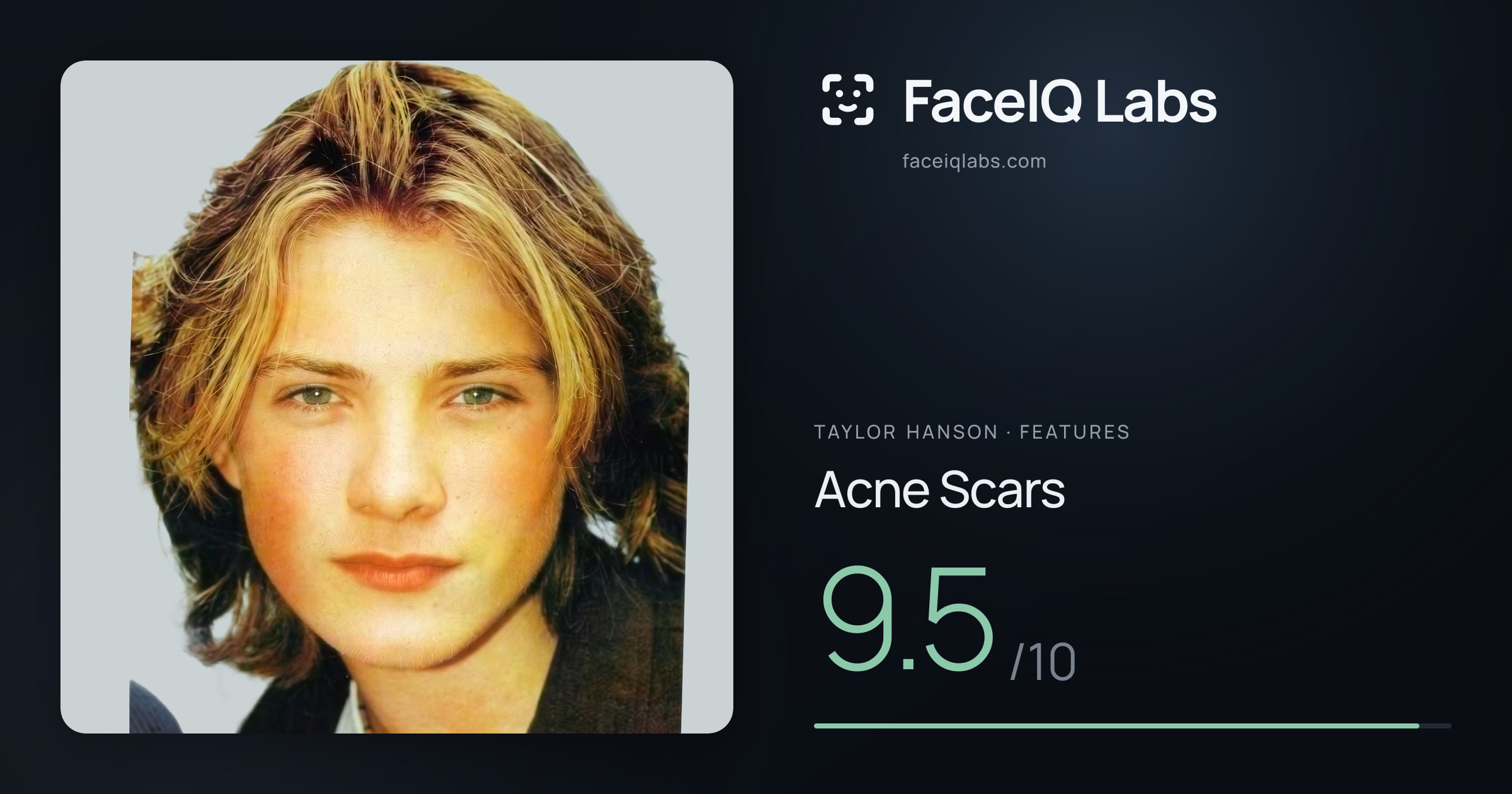 Taylor Hanson Acne Scars: 9.5/10, drawn on the photo