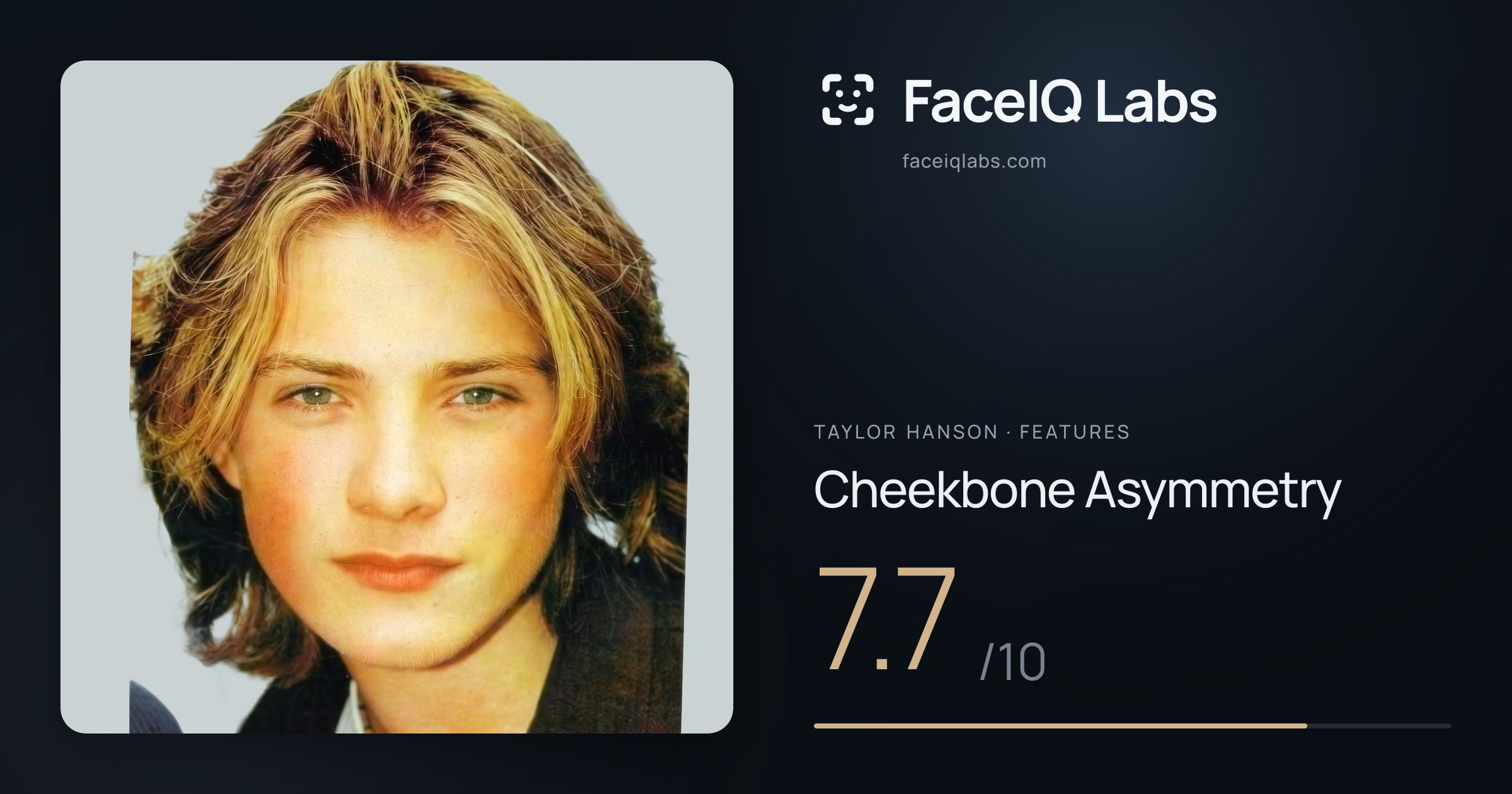 Taylor Hanson Cheekbone Asymmetry: 7.7/10, drawn on the photo