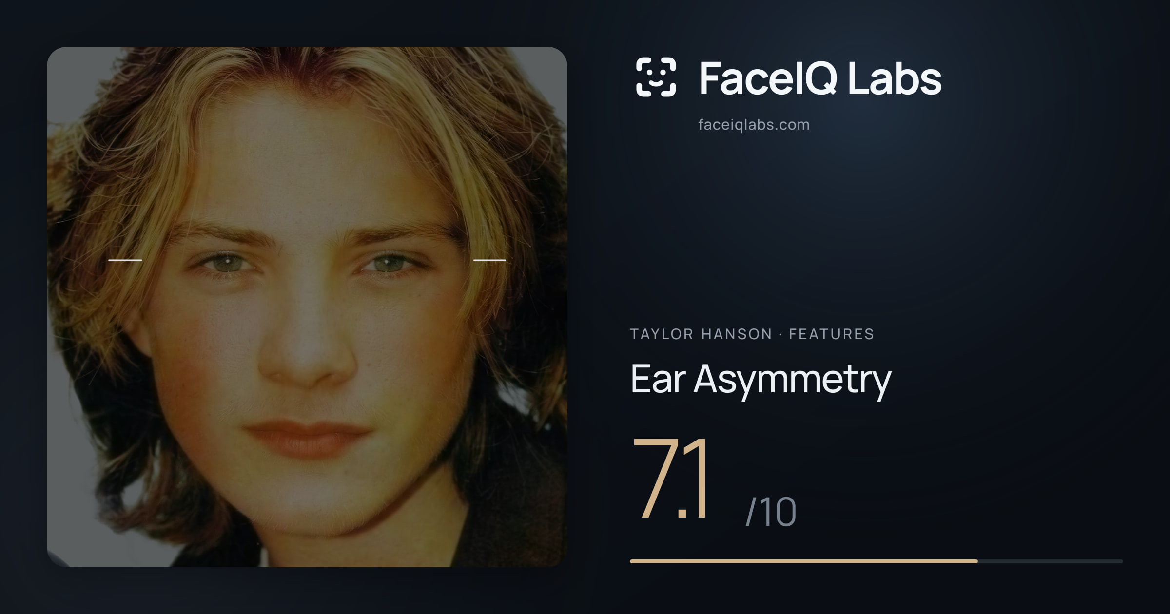 Taylor Hanson Ear Asymmetry: 7.1/10, drawn on the photo