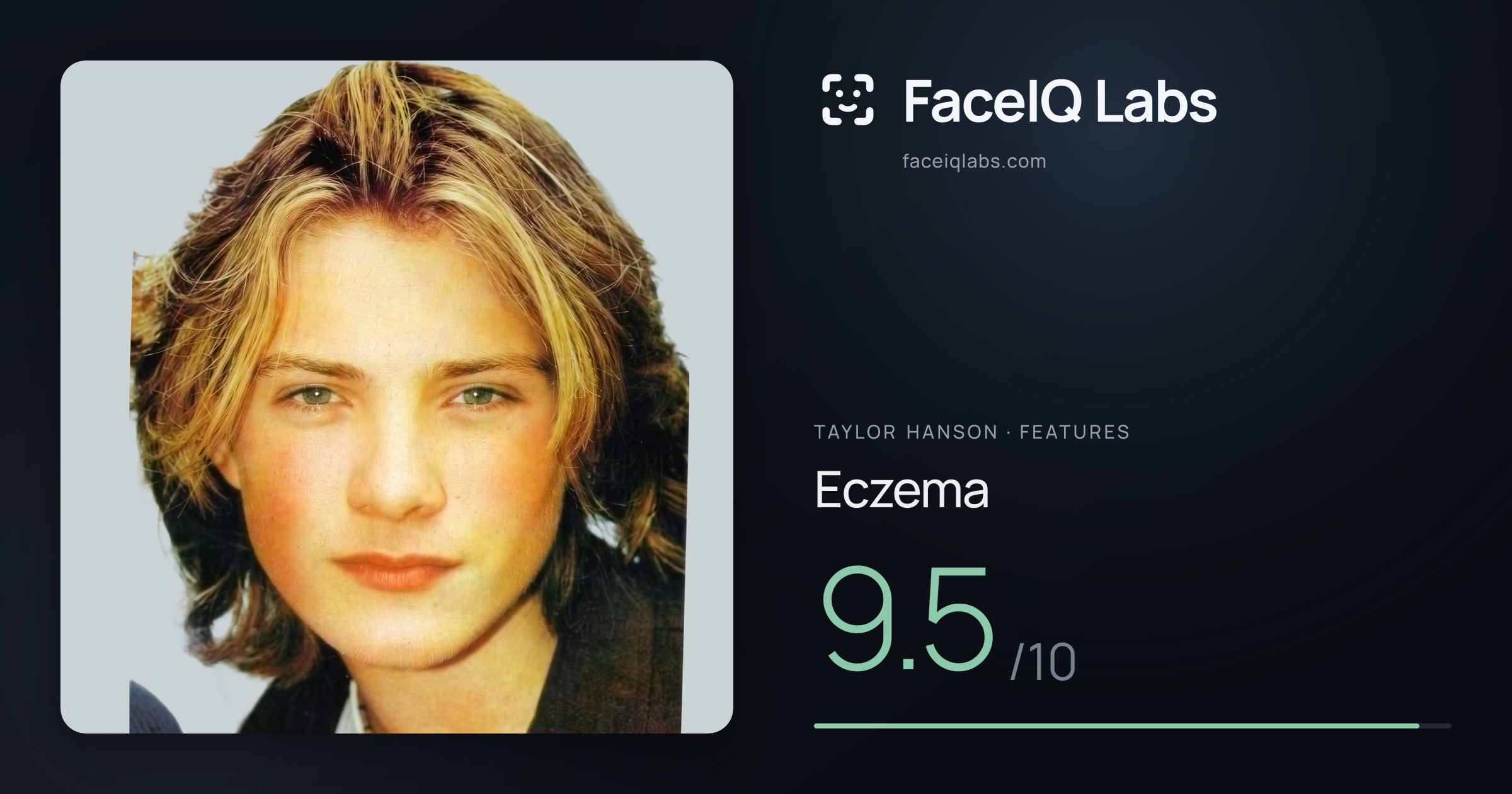 Taylor Hanson Eczema: 9.5/10, drawn on the photo