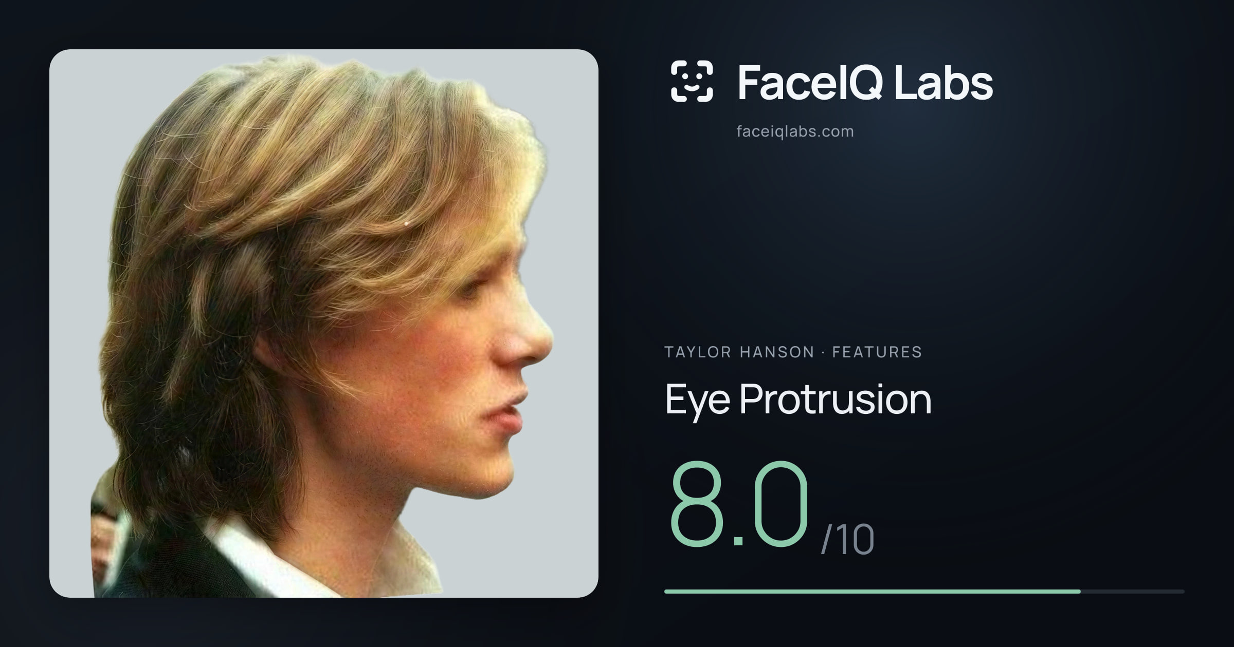 Taylor Hanson Eye Protrusion: 8.0/10, drawn on the photo