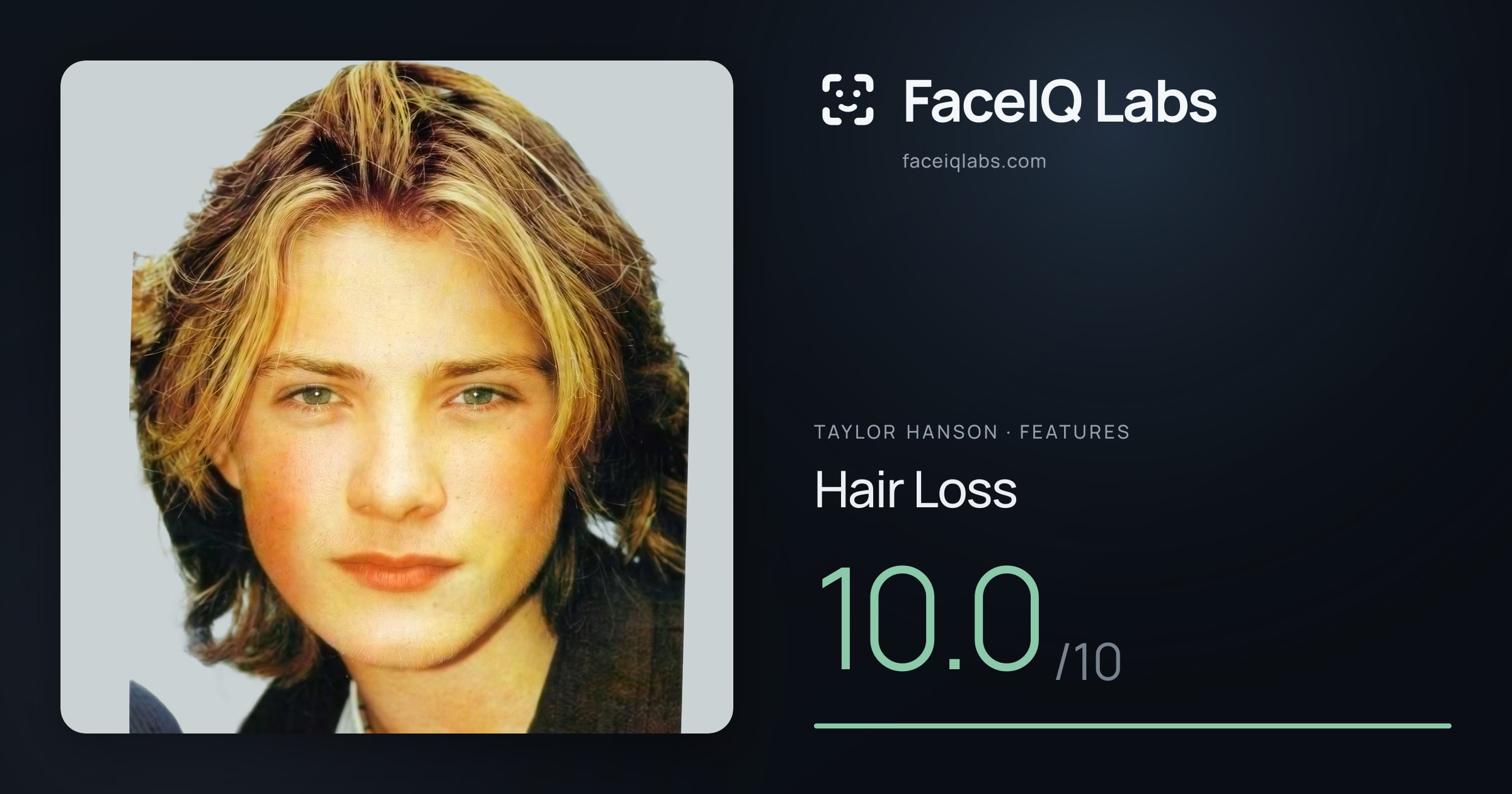 Taylor Hanson Hair Loss: 10.0/10, drawn on the photo