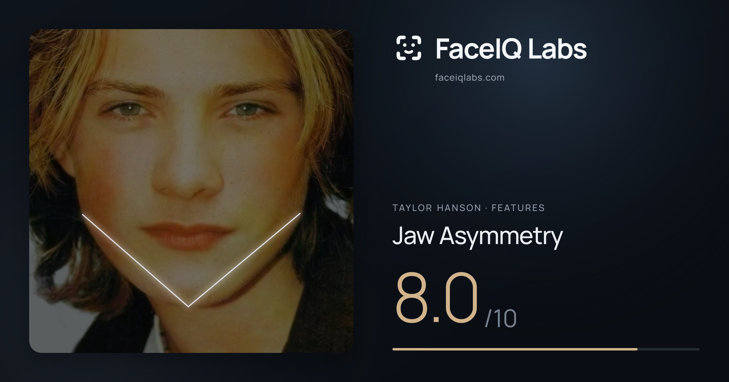 Taylor Hanson Jaw Asymmetry: 8.0/10, drawn on the photo