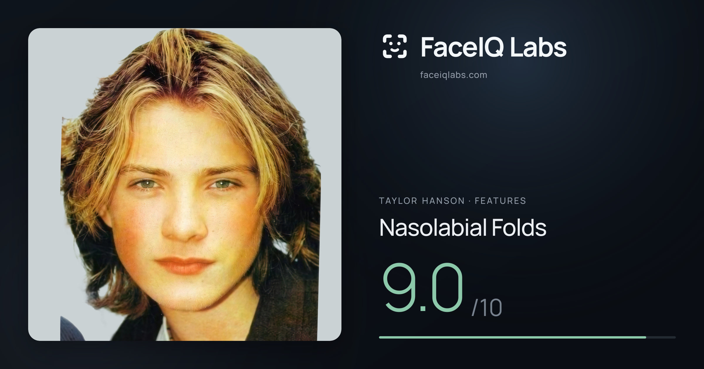 Taylor Hanson Nasolabial Folds: 9.0/10, drawn on the photo