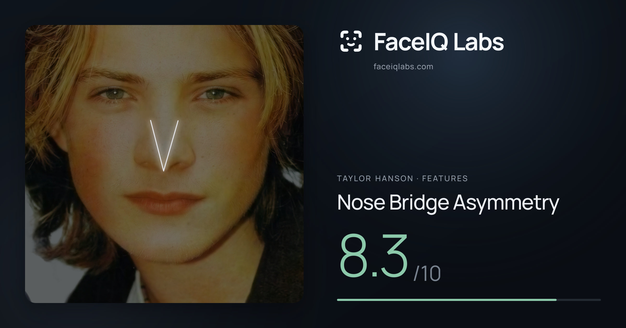 Taylor Hanson Nose Bridge Asymmetry: 8.3/10, drawn on the photo