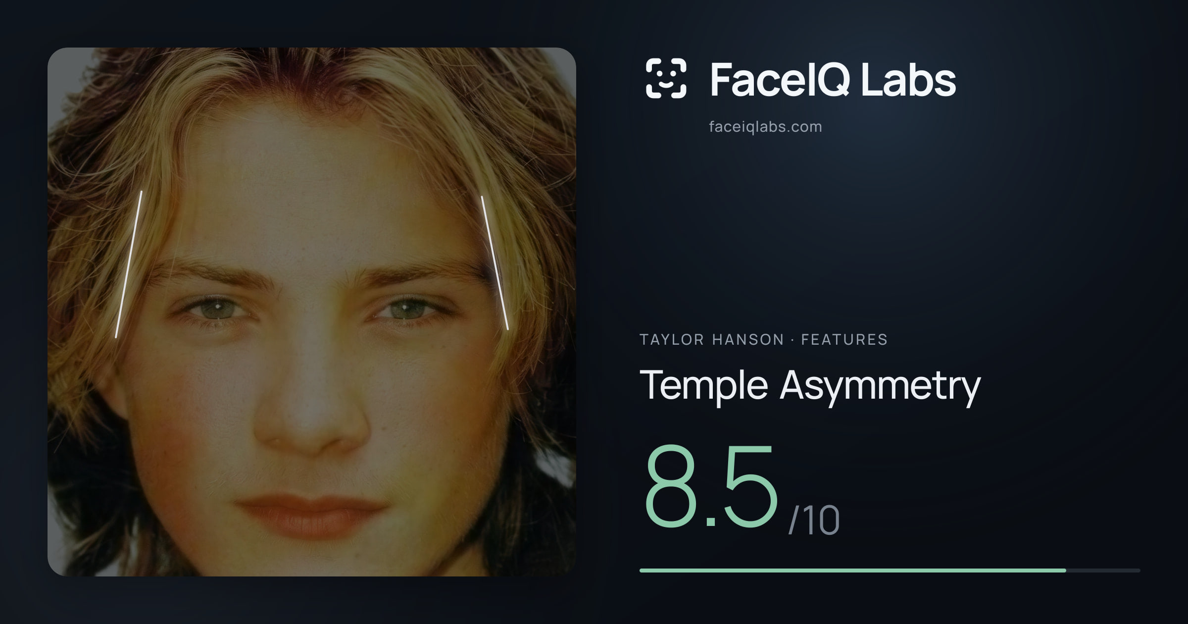 Taylor Hanson Temple Asymmetry: 8.5/10, drawn on the photo