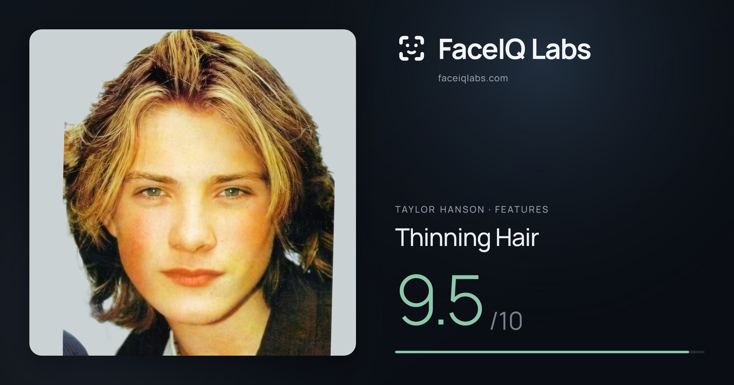 Taylor Hanson Thinning Hair: 9.5/10, drawn on the photo