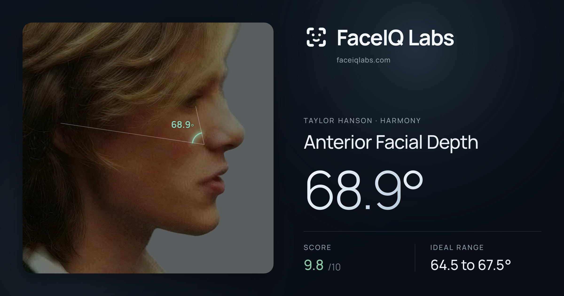 Taylor Hanson Anterior Facial Depth: 68.9°, drawn on the photo