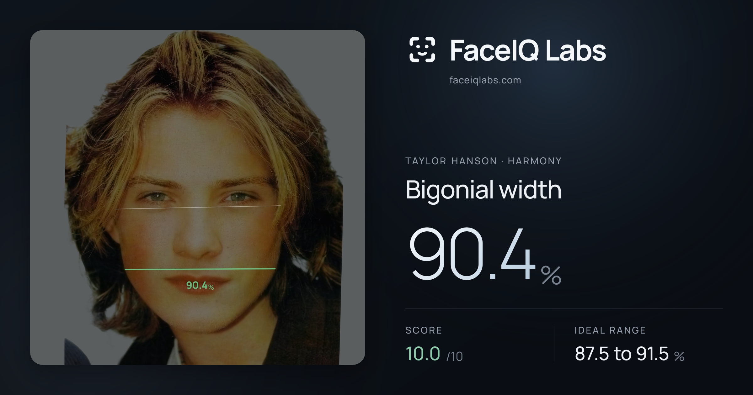 Taylor Hanson Bigonial width: 90.4%, drawn on the photo