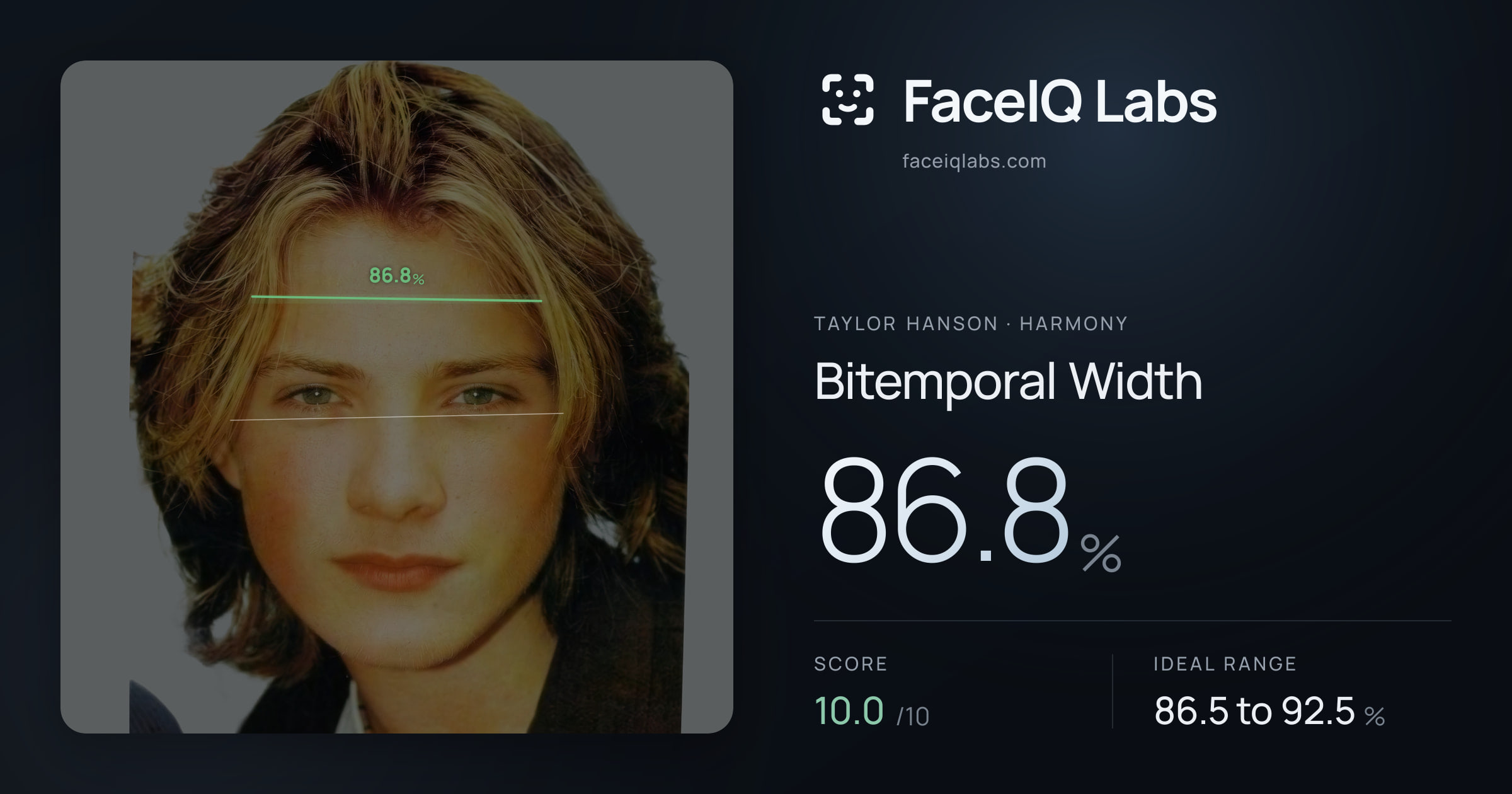 Taylor Hanson Bitemporal Width: 86.8%, drawn on the photo