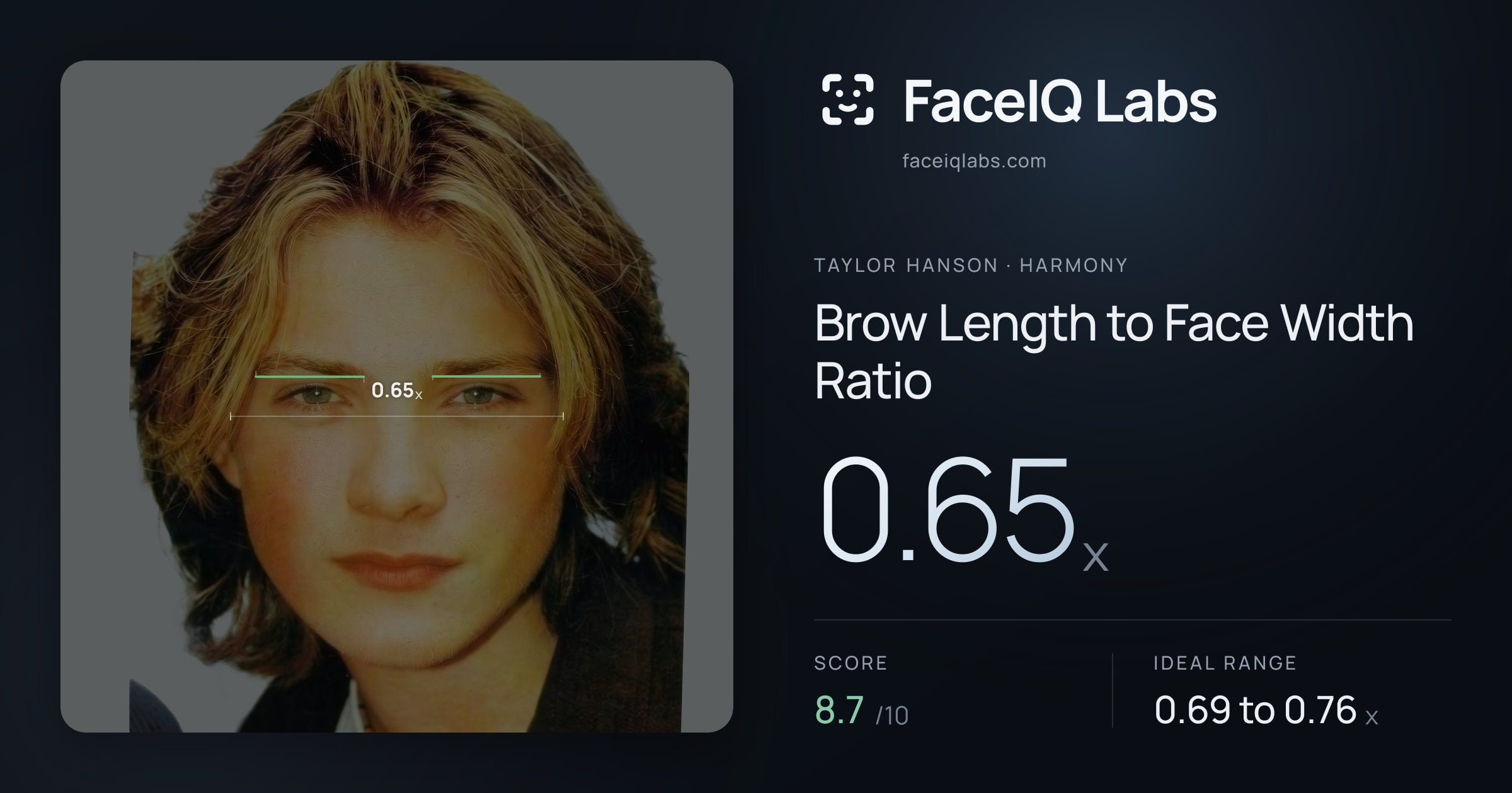 Taylor Hanson Brow Length to Face Width Ratio: 0.65x, drawn on the photo