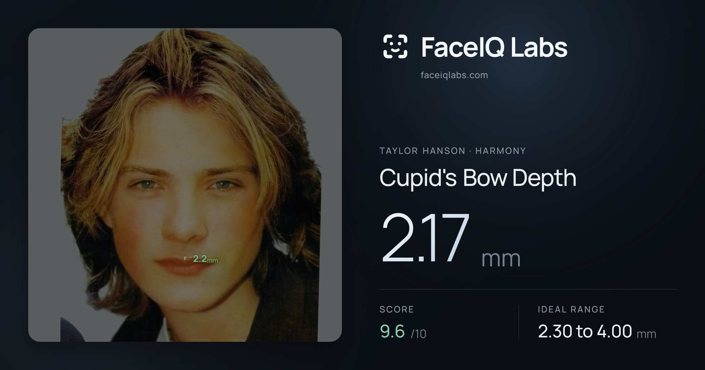 Taylor Hanson Cupid's Bow Depth: 2.17mm, drawn on the photo